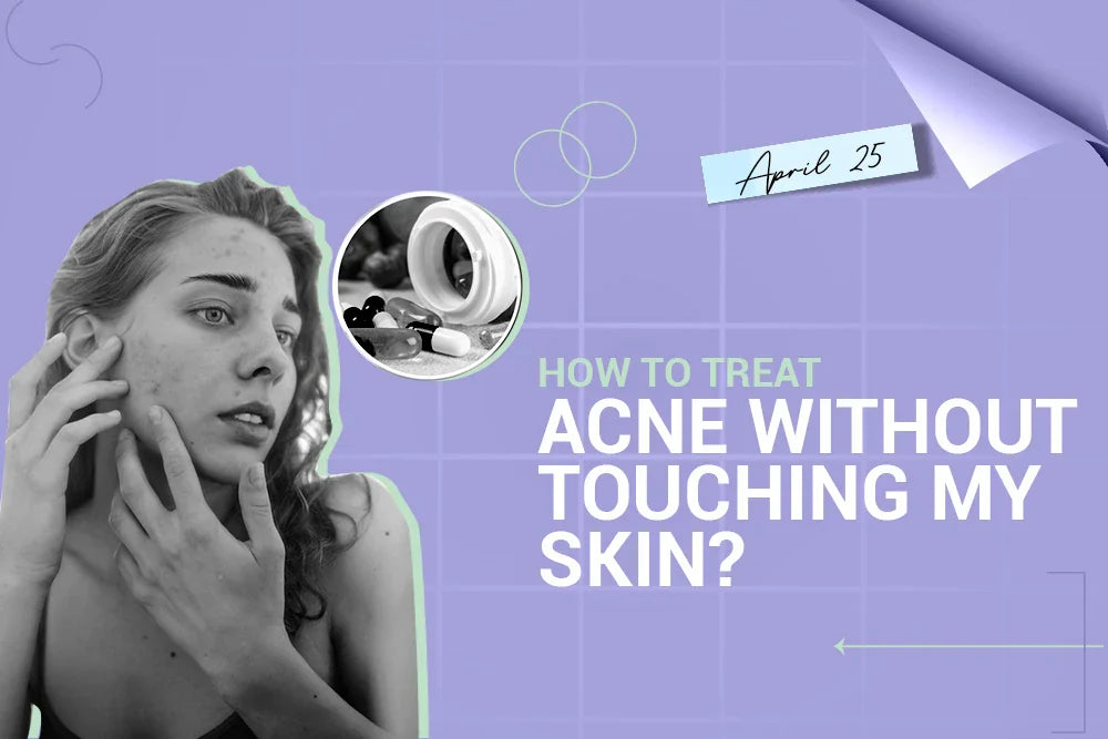 How to Treat Acne Without Touching My Skin? How to Treat Acne Without Touching My Skin?