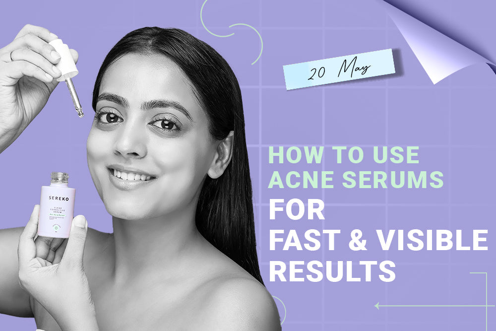 How to Use Acne Serums for Fast & Visible Results How to Use Acne Serums for Fast & Visible Results