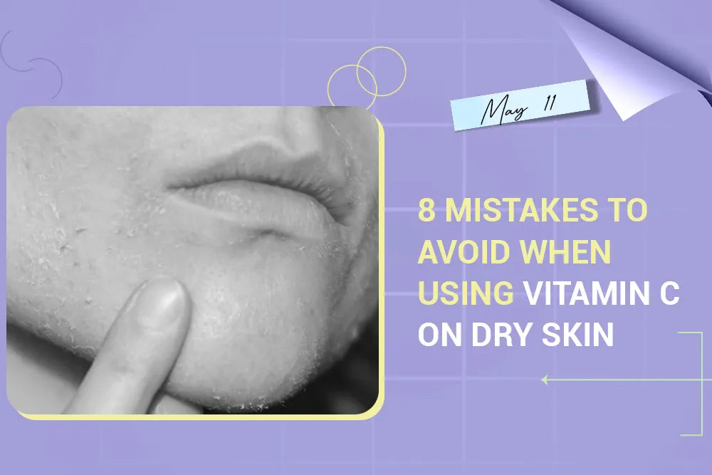 8 Mistakes to Avoid When Using Vitamin C on Dry Skin 8 Mistakes to Avoid When Using Vitamin C on Dry Skin