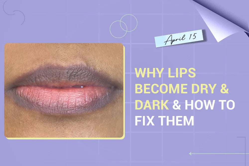 Why Lips Become Dry and Dark & How to Fix Them Why Lips Become Dry and Dark & How to Fix Them