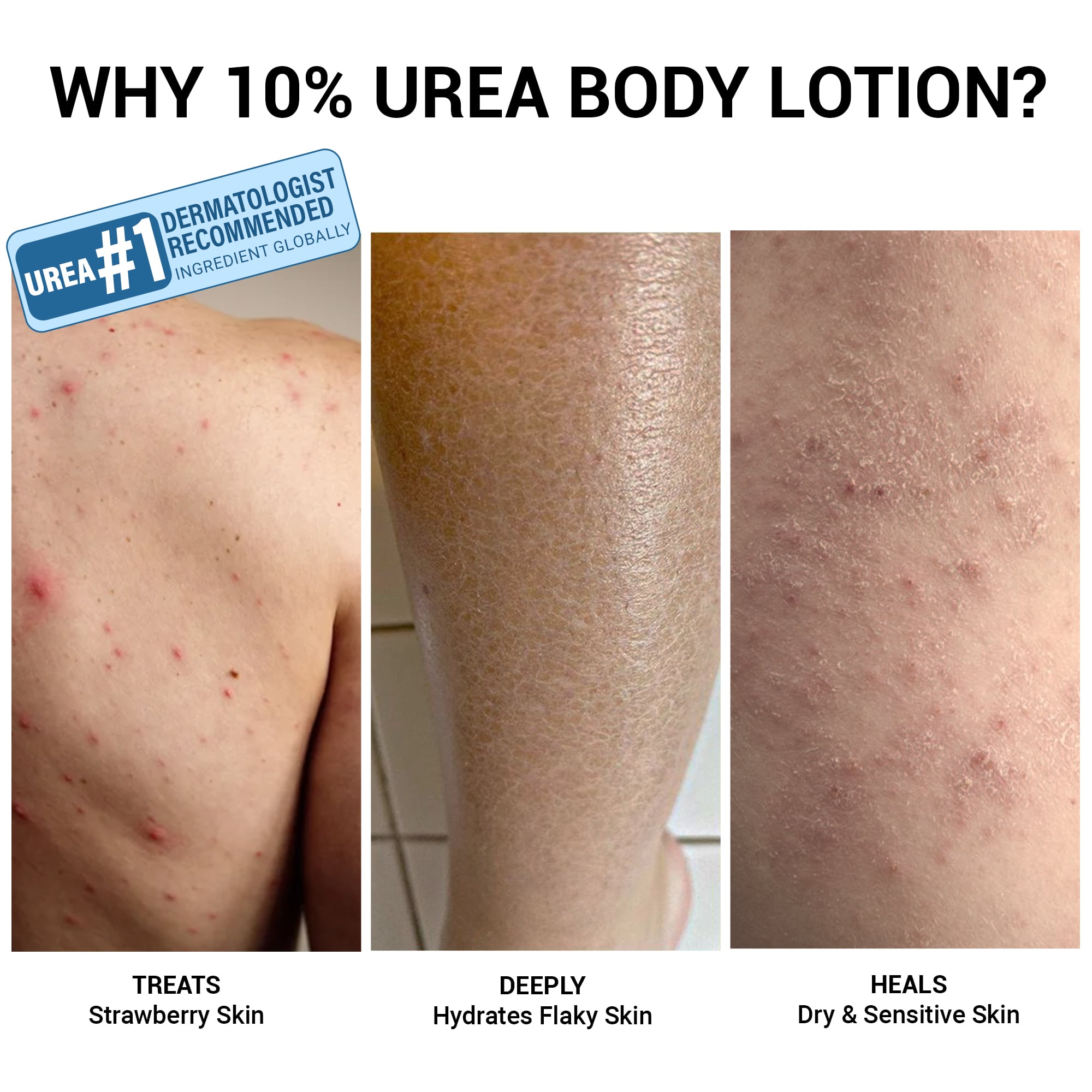 Product media Hydra-Repair 10% Urea and Avocado Oil Body Lotion