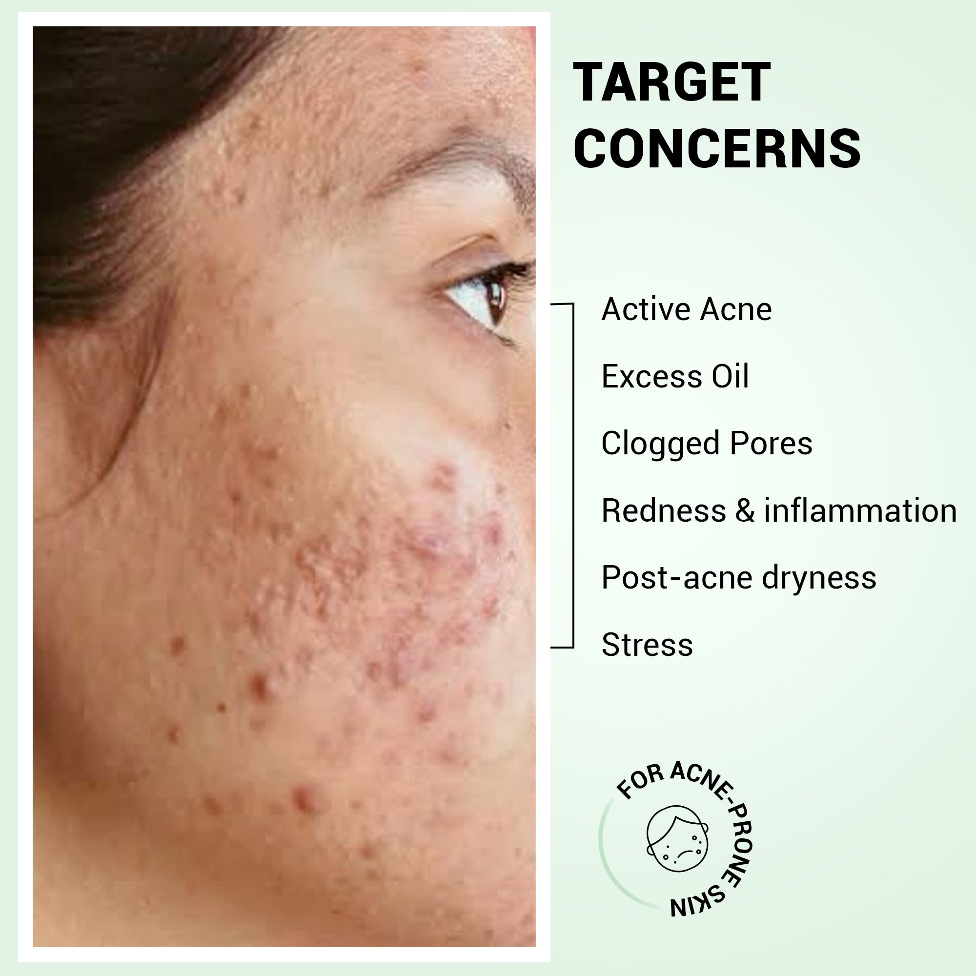 Product media Anti-Acne Duo
