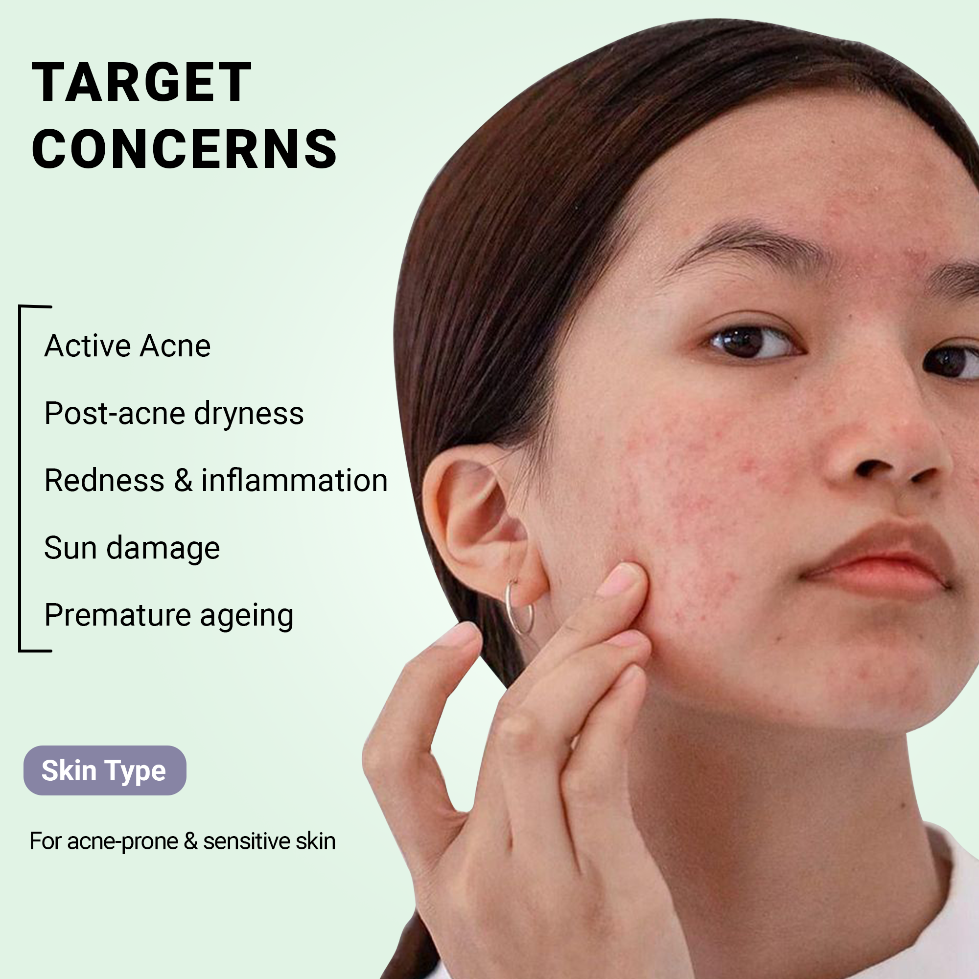 Product media Acne Control Combo
