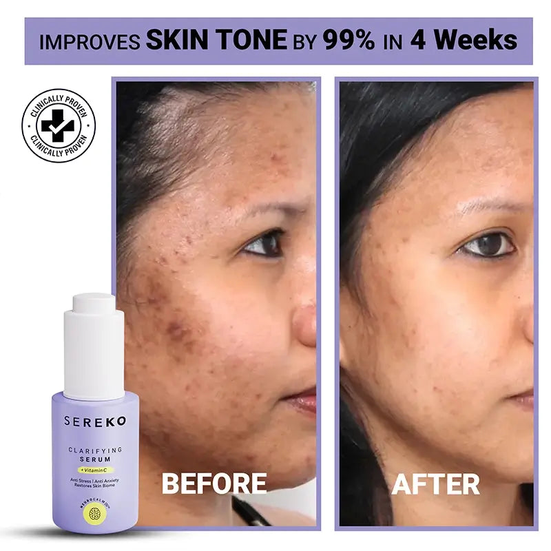 Product media serum for acne marks