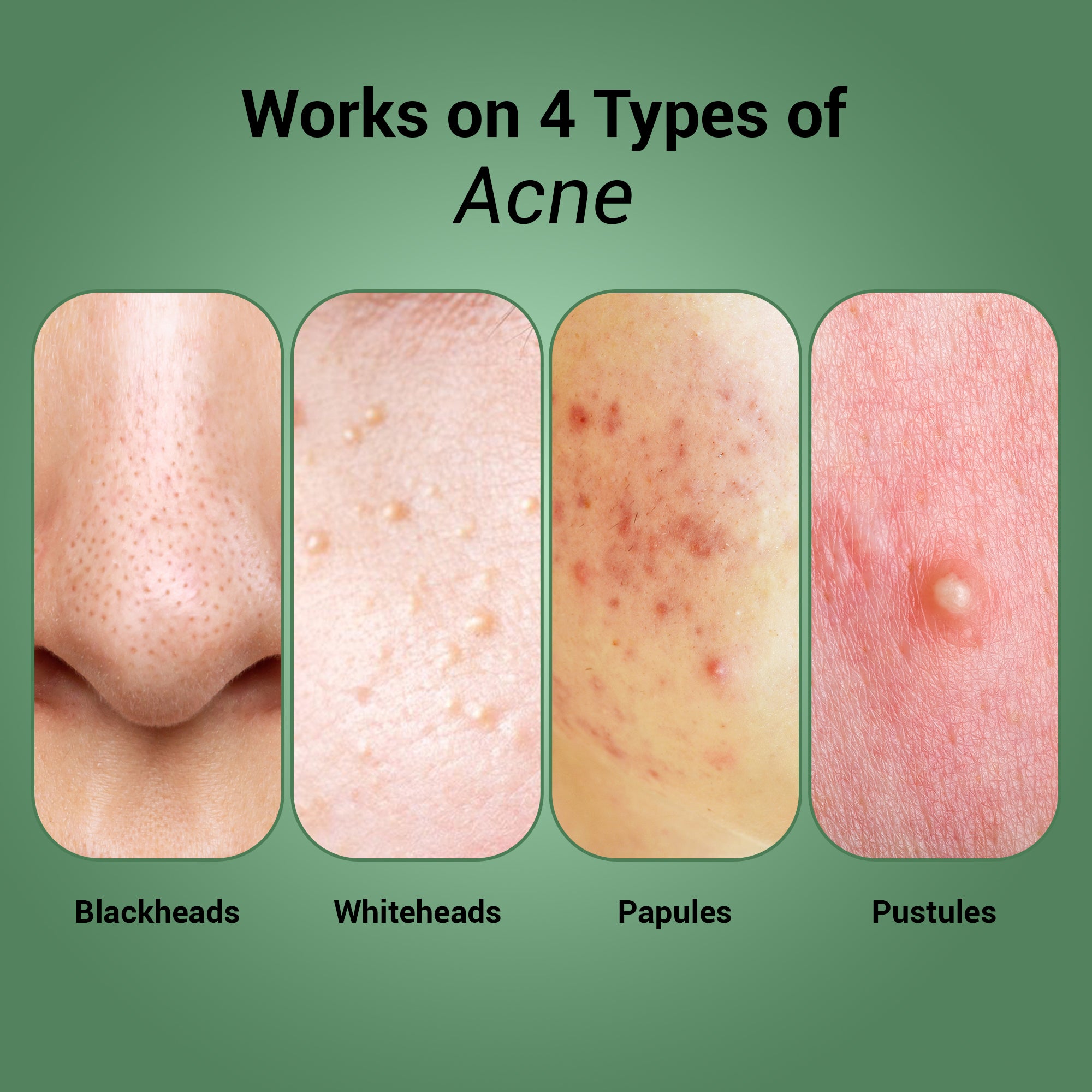 Product media Pore Clearing Wash