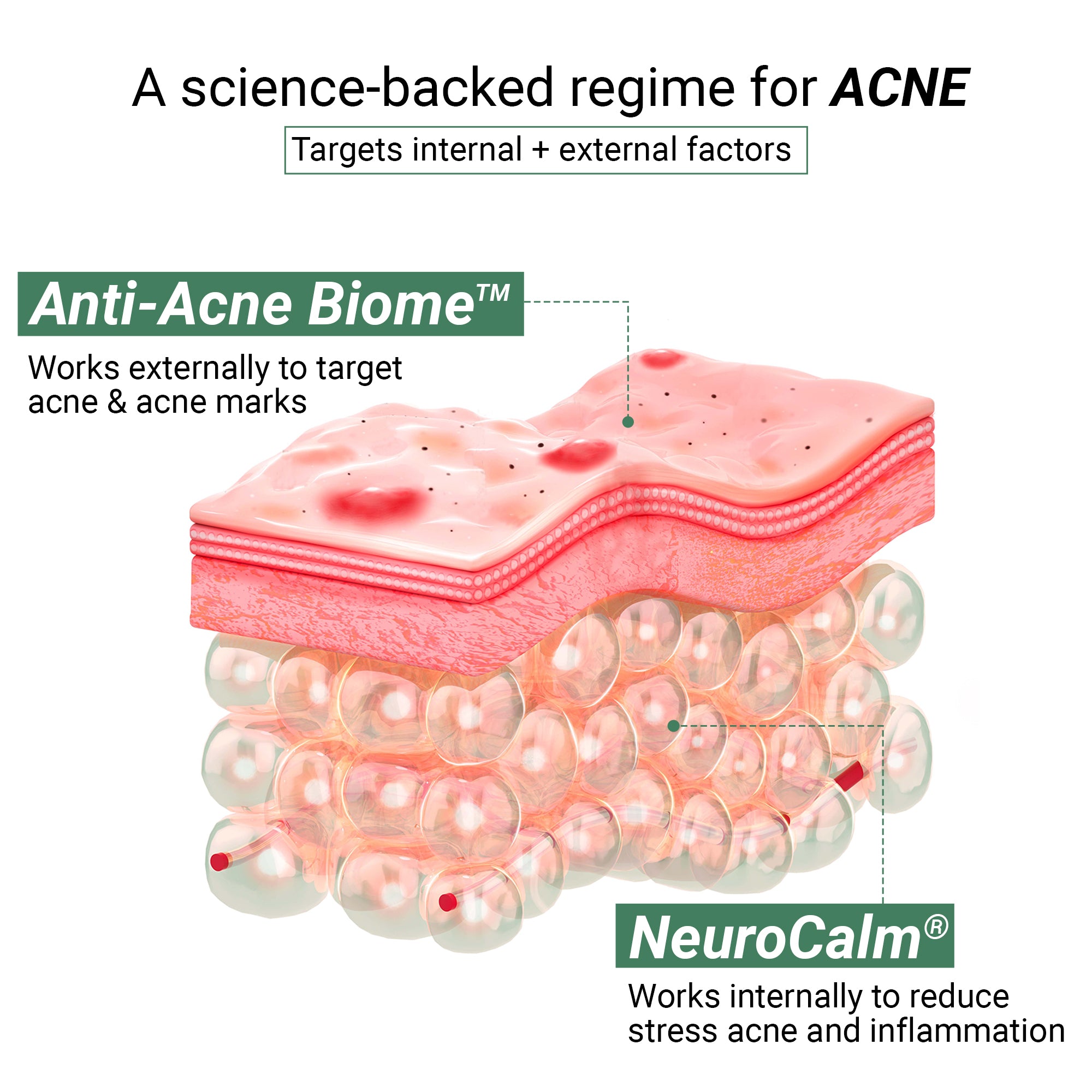 Product media Anti-Acne Advanced Detox Kit