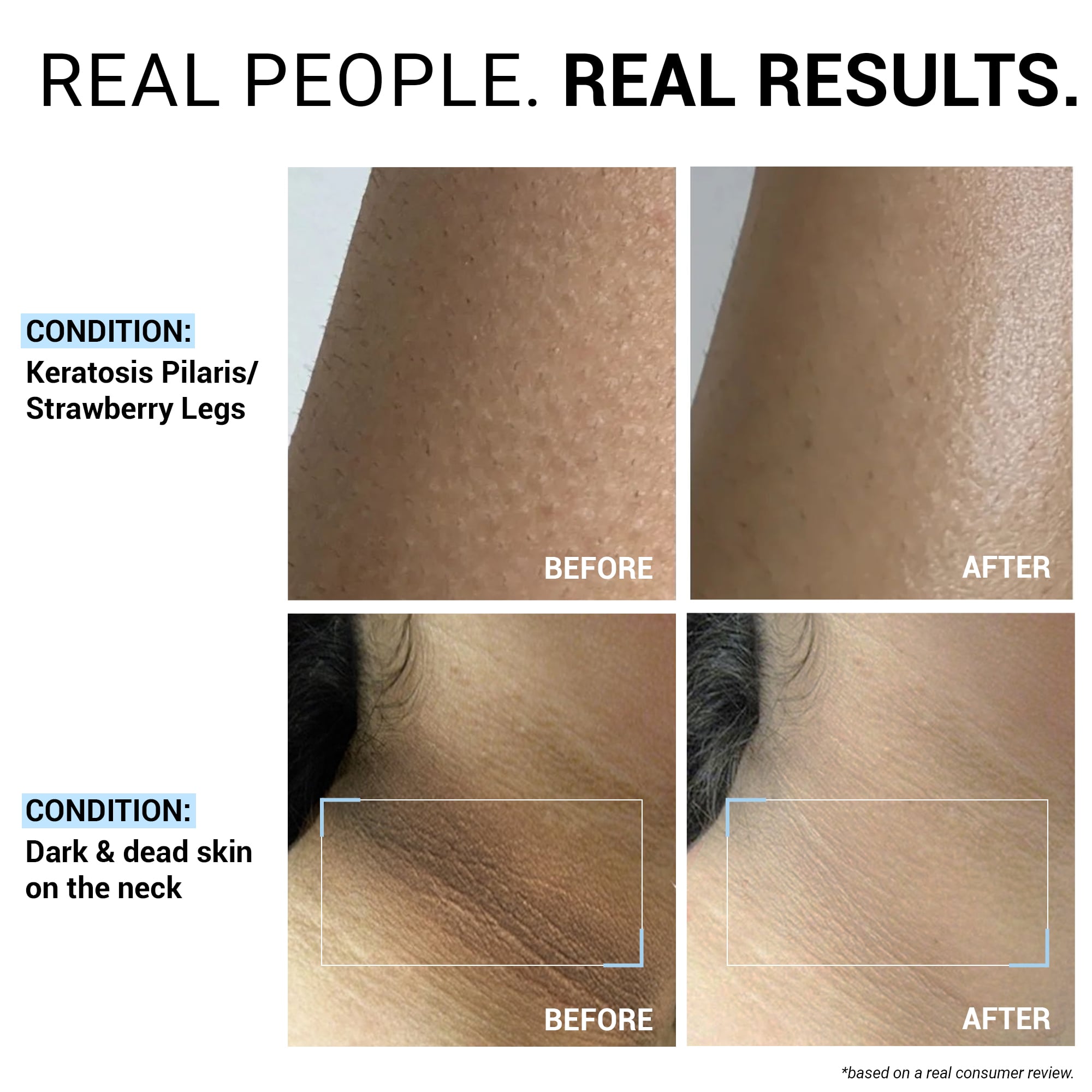 Product media Hydra-Repair 5% Urea & Avocado Oil Body Wash
