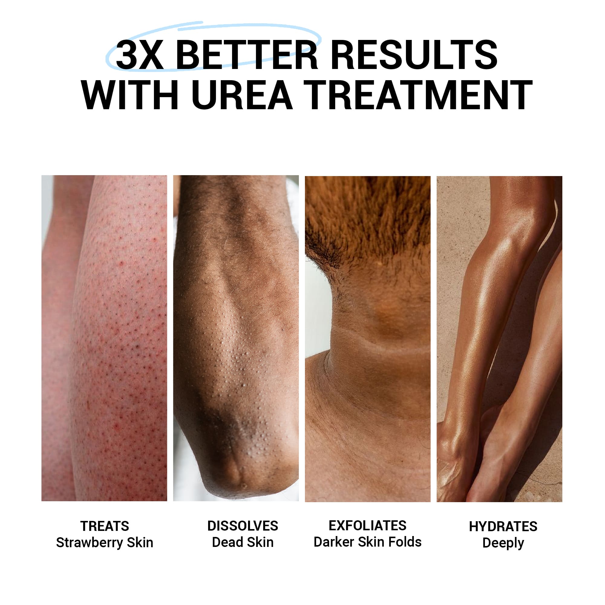 Product media 48hr Dry Skin Relief Body Wash & Body Lotion Combo with Urea Treatment