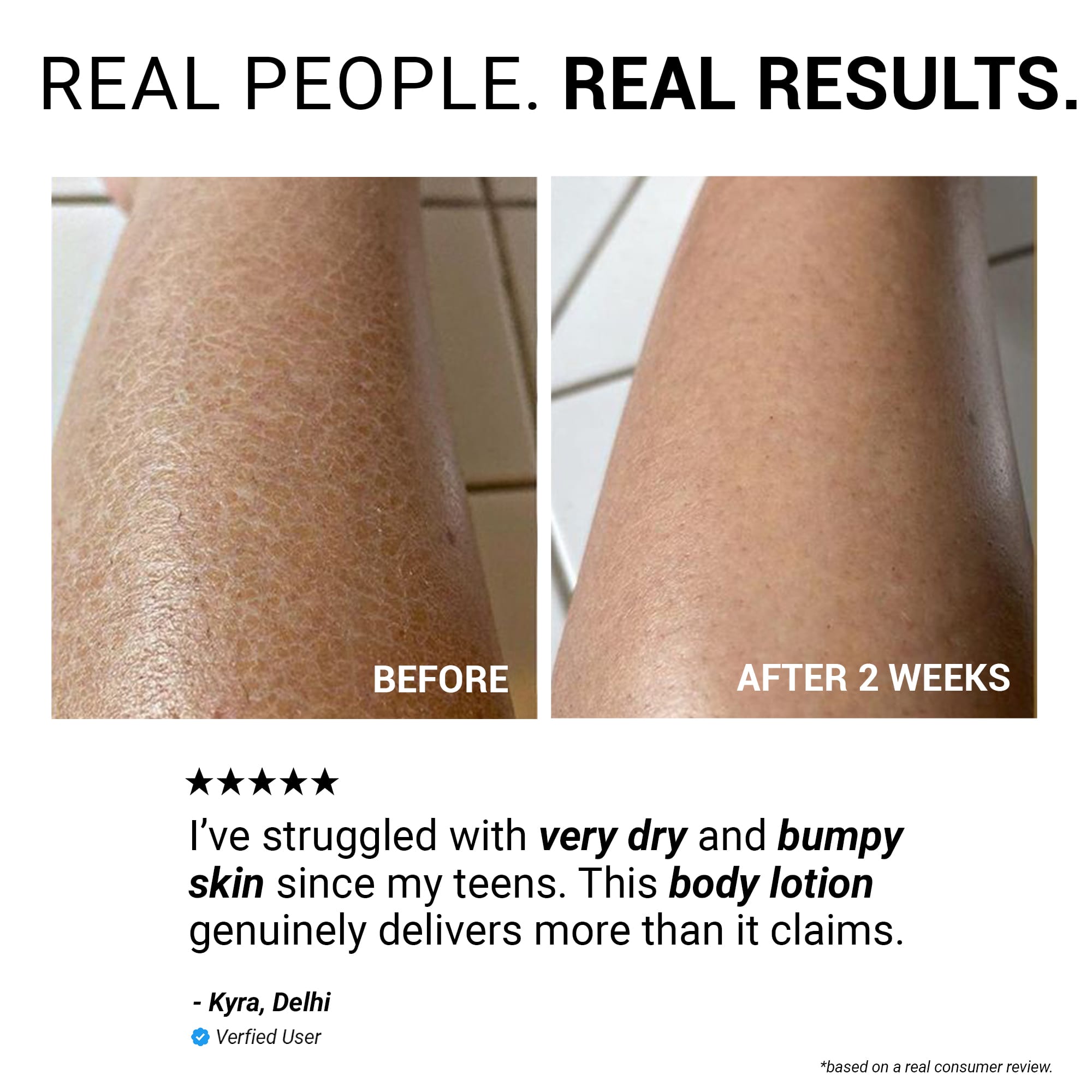 Product media Hydra-Repair 10% Urea and Avocado Oil Body Lotion