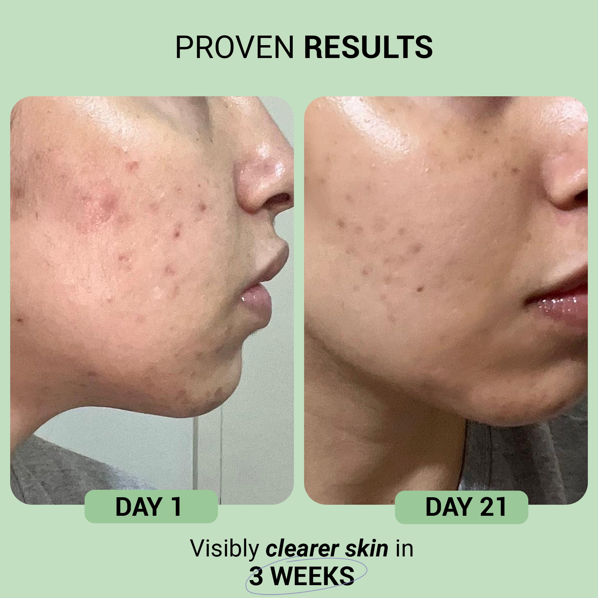 Product media Syrup for clear skin