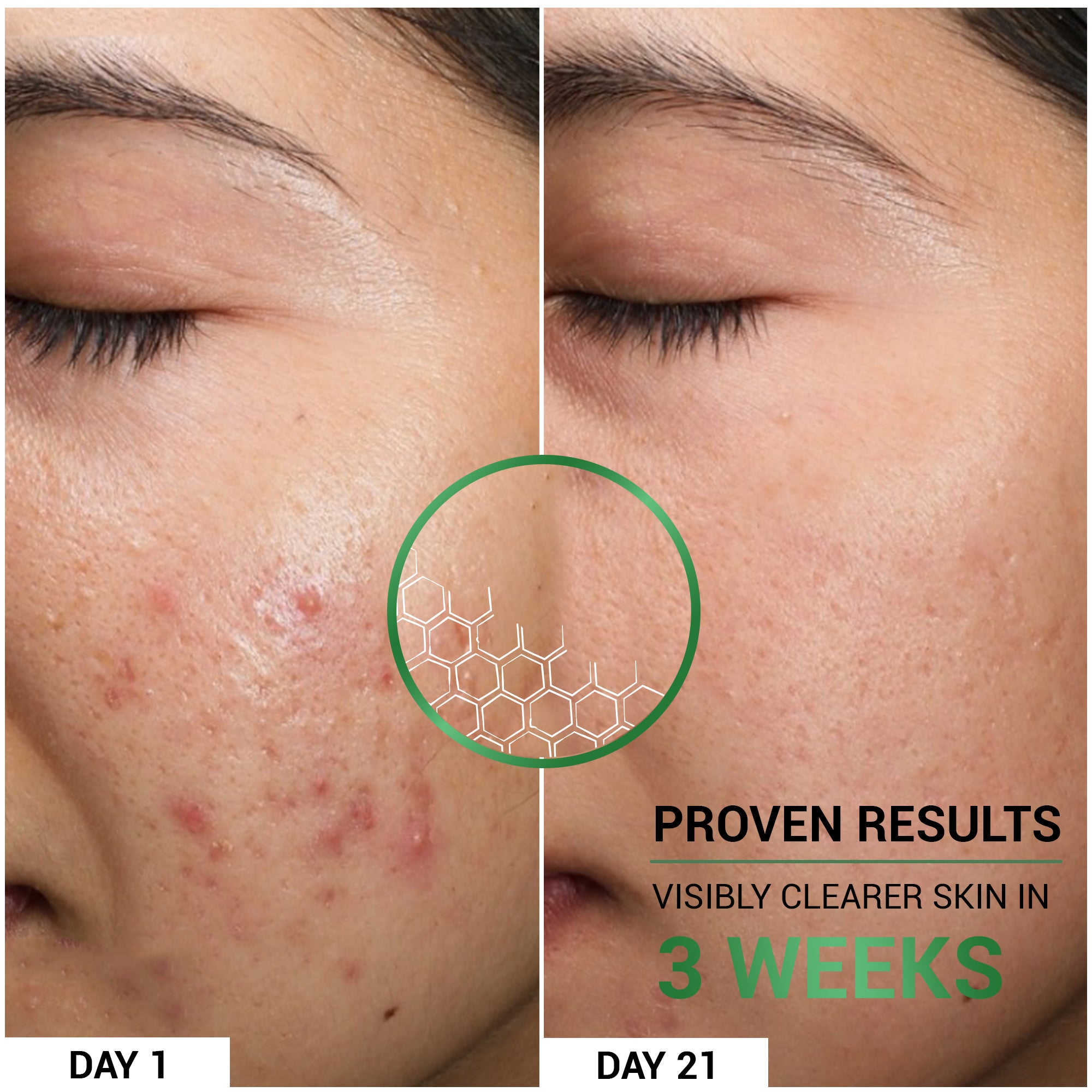 Product media Oil Clear Moisturizer