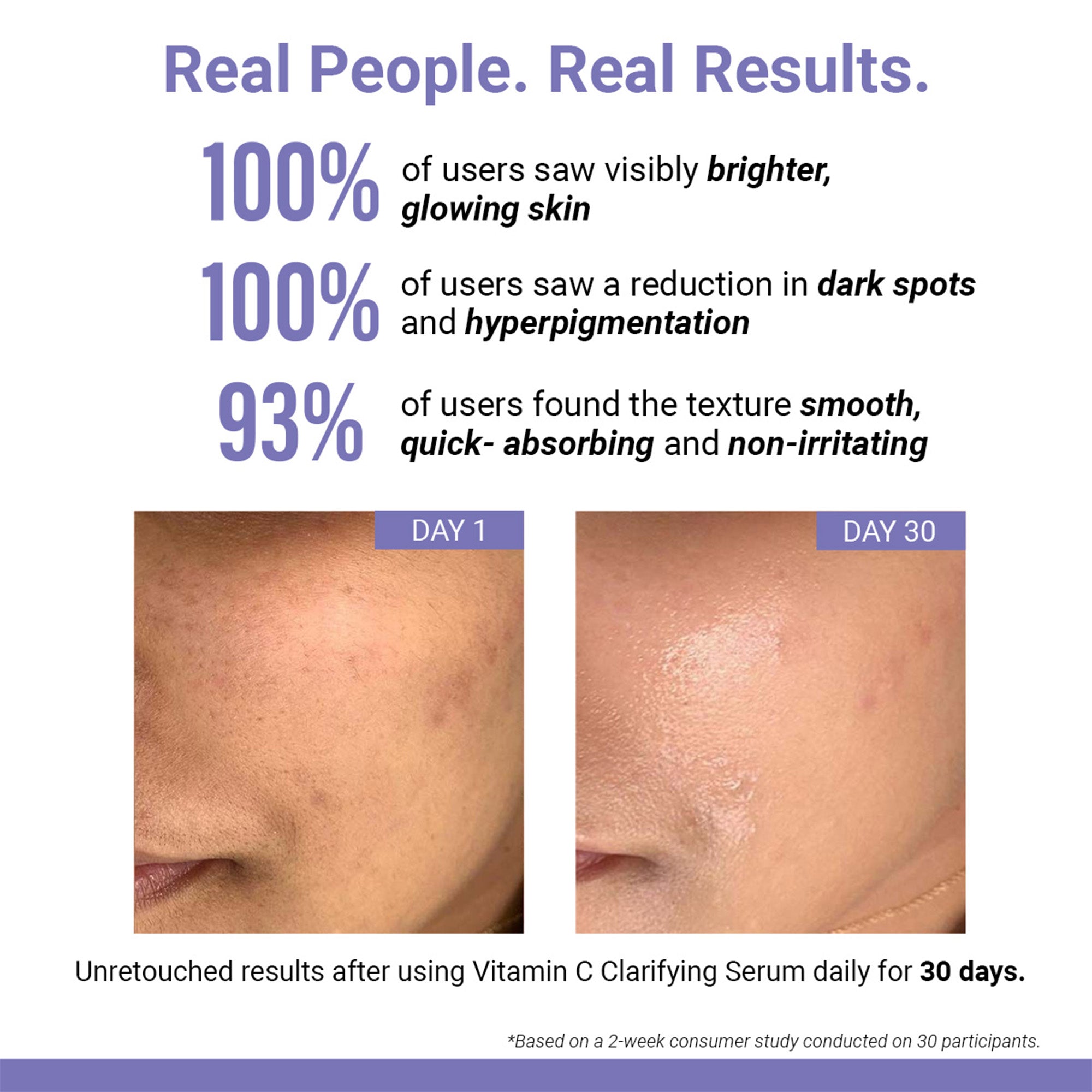 Product media Skin Brightening | Vitamin C Face Serum