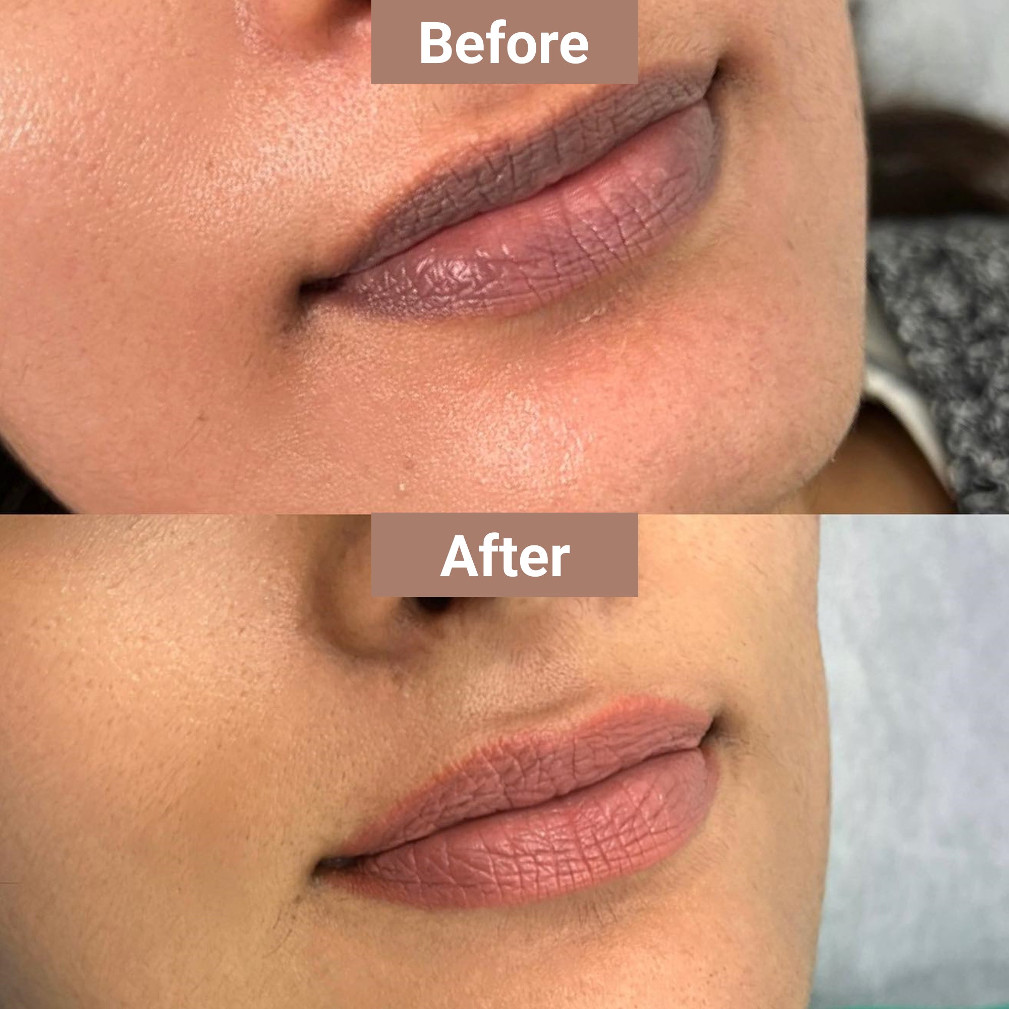 Product media lip balm for dark lips