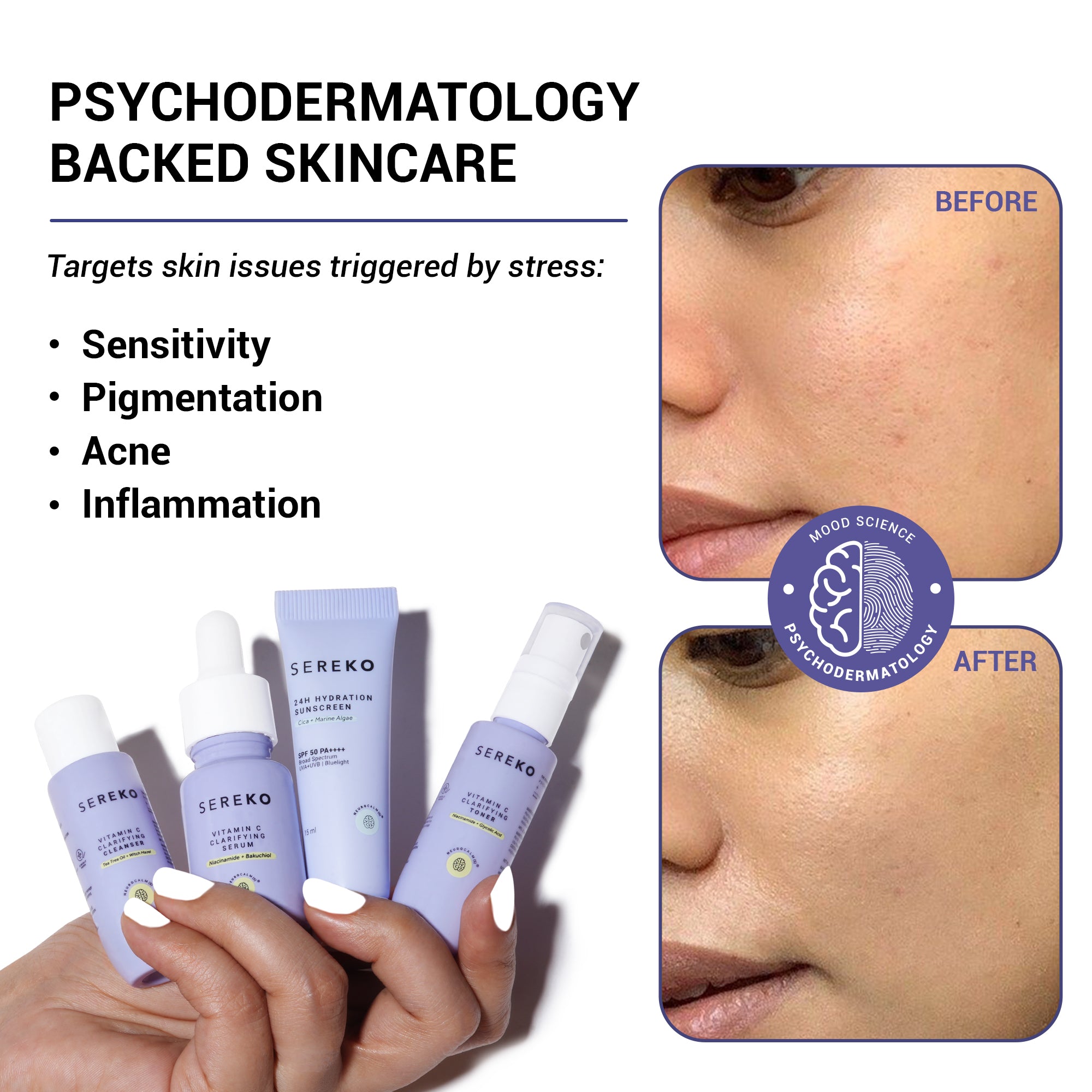 Product media Bestsellers 4 Step Kit Before and After