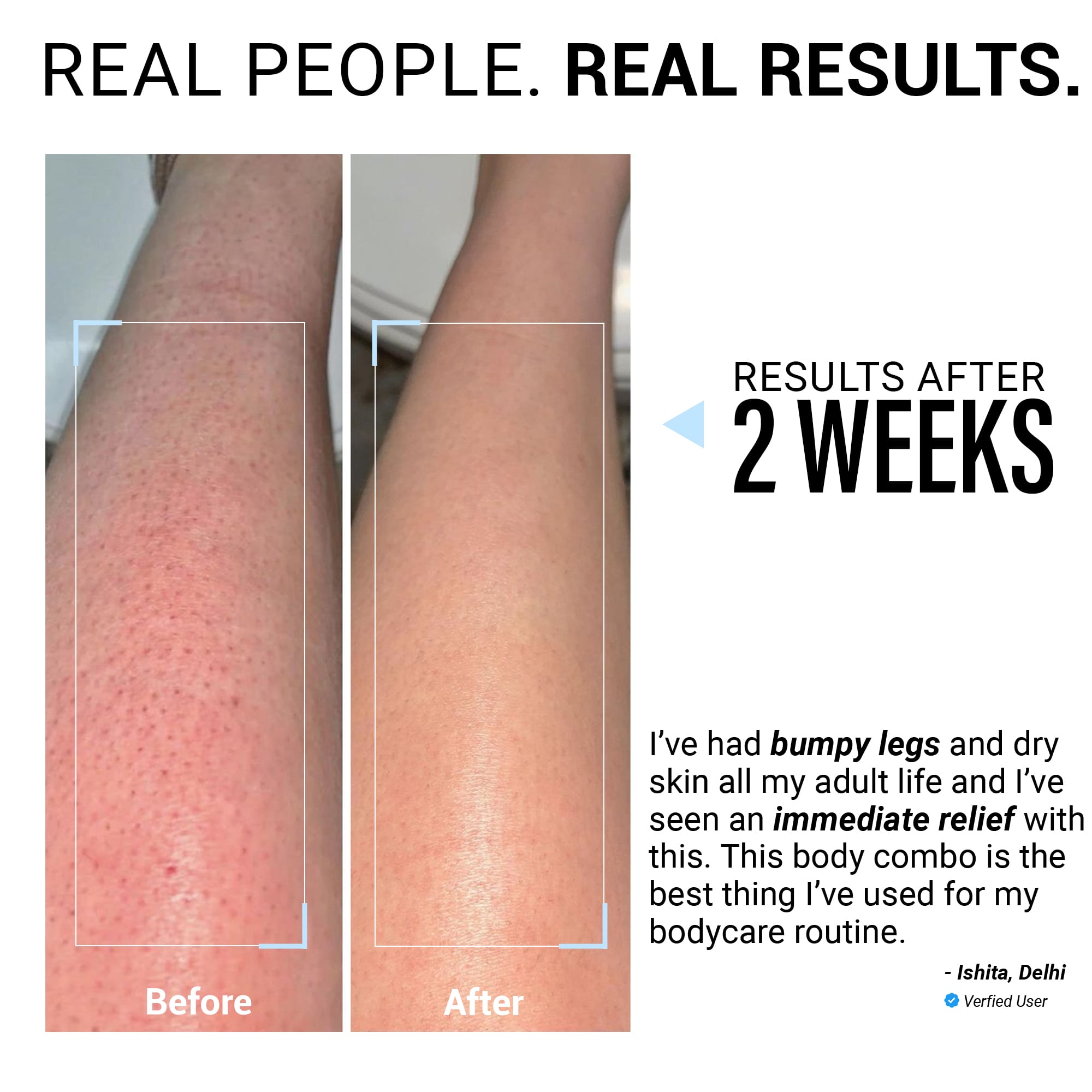 Product media 48hr Dry Skin Relief Body Wash & Body Lotion Combo with Urea Treatment