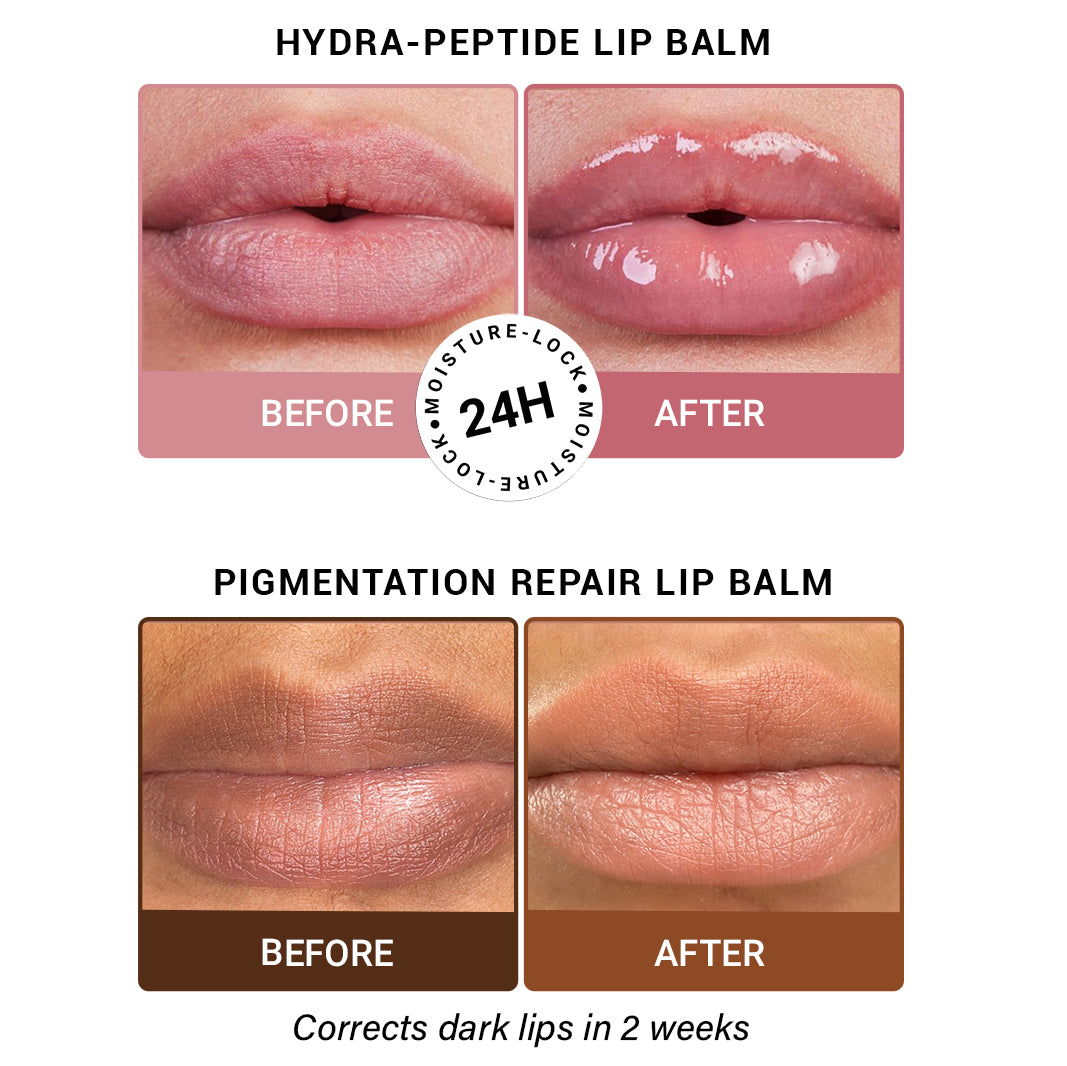 Product media Brighten & Hydrate AM-PM Lip Balm Combo