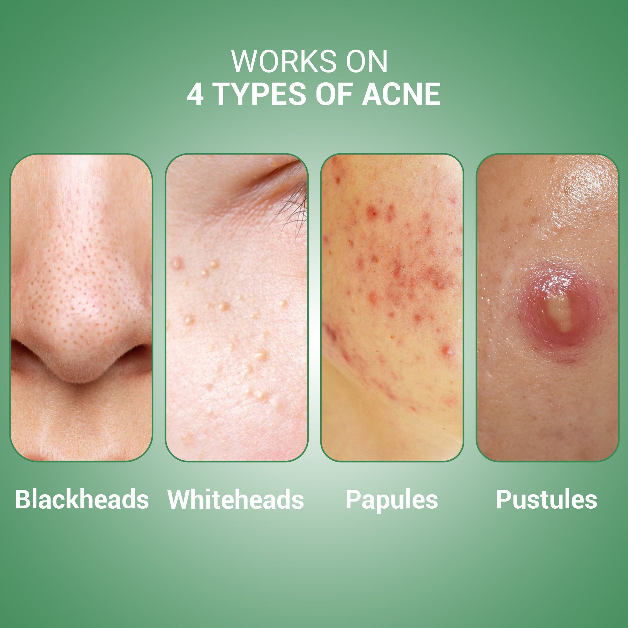 Product media Best syrup for glowing skin