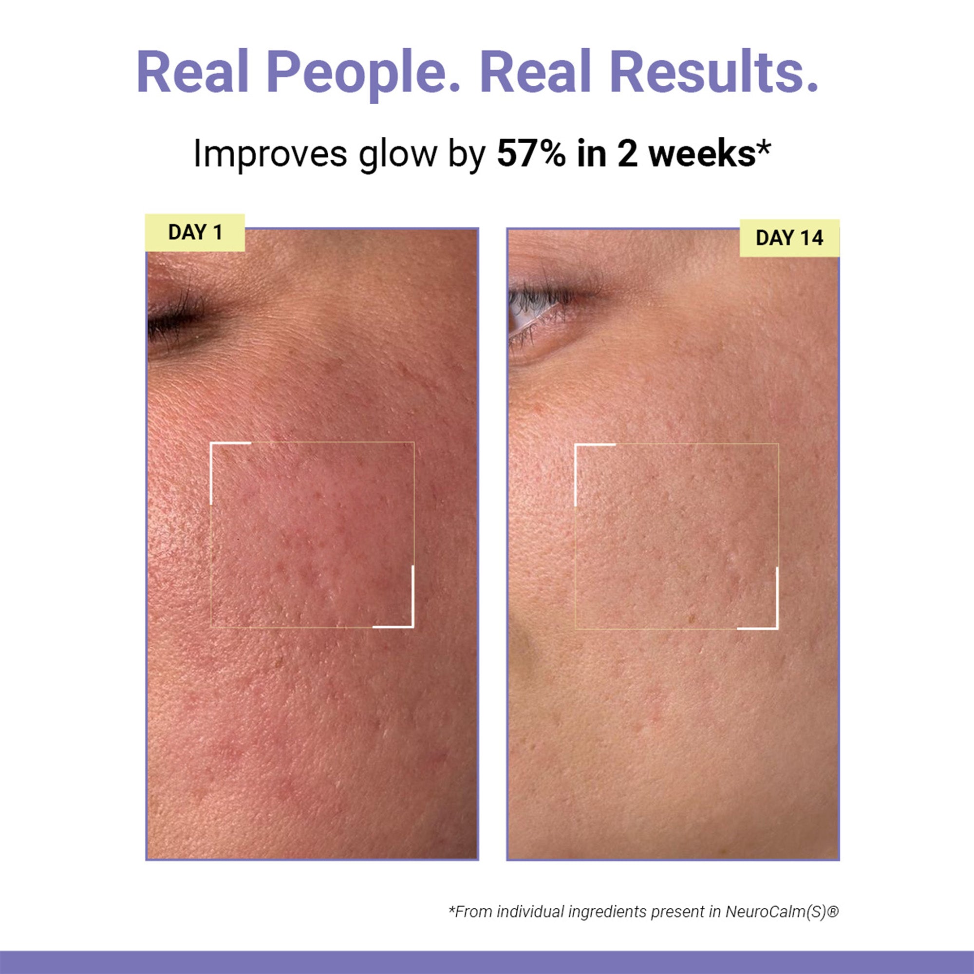Product media Skin Brightening | Vitamin C Face Toner