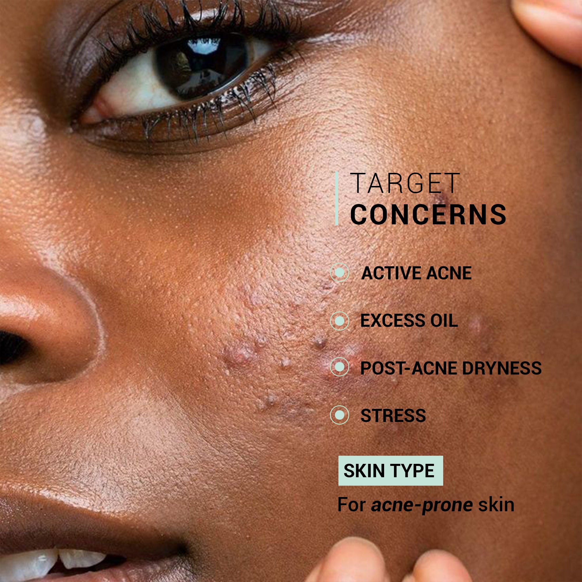 Product media Oil Clear Moisturizer