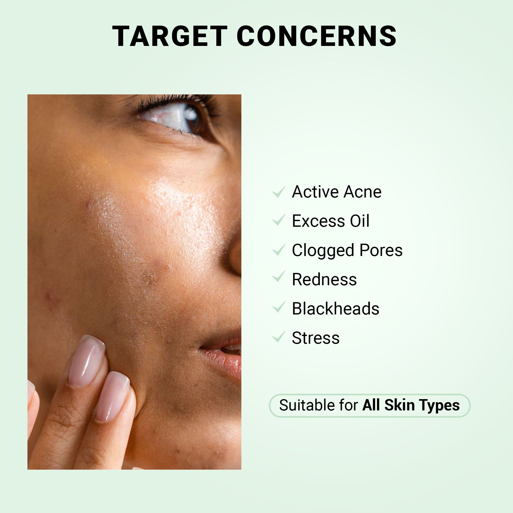 Product media Anti-Acne Advanced Detox Kit