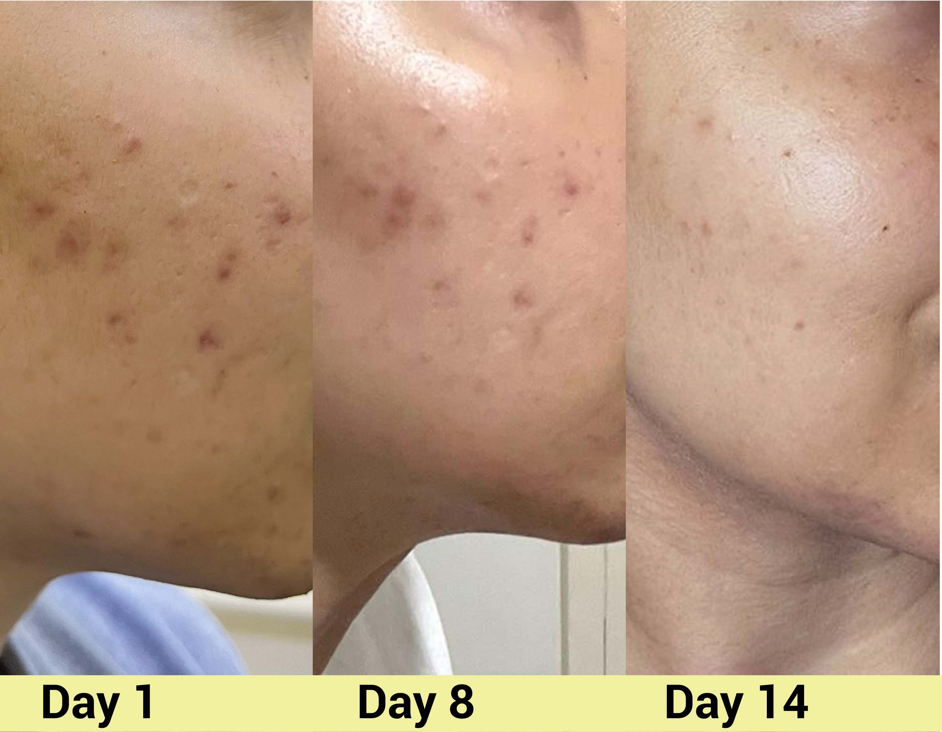 After image Real People. Real Results.