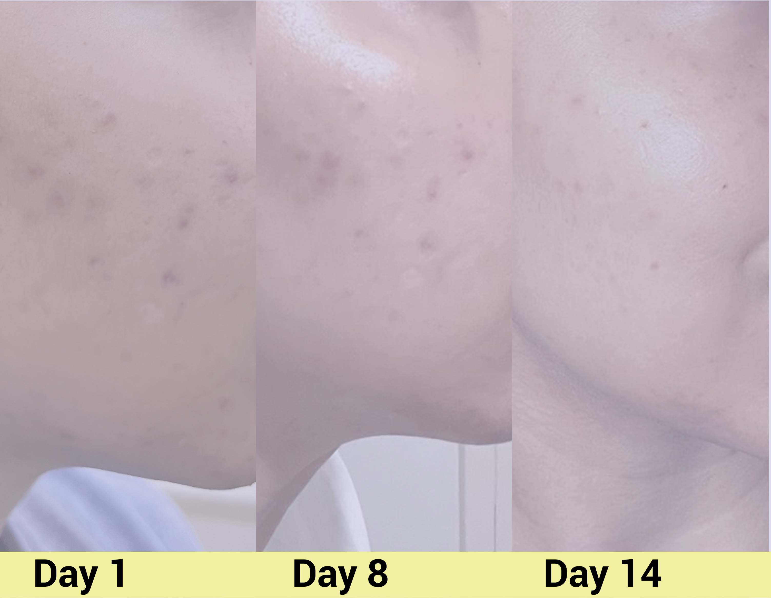 Before image Real People. Real Results.