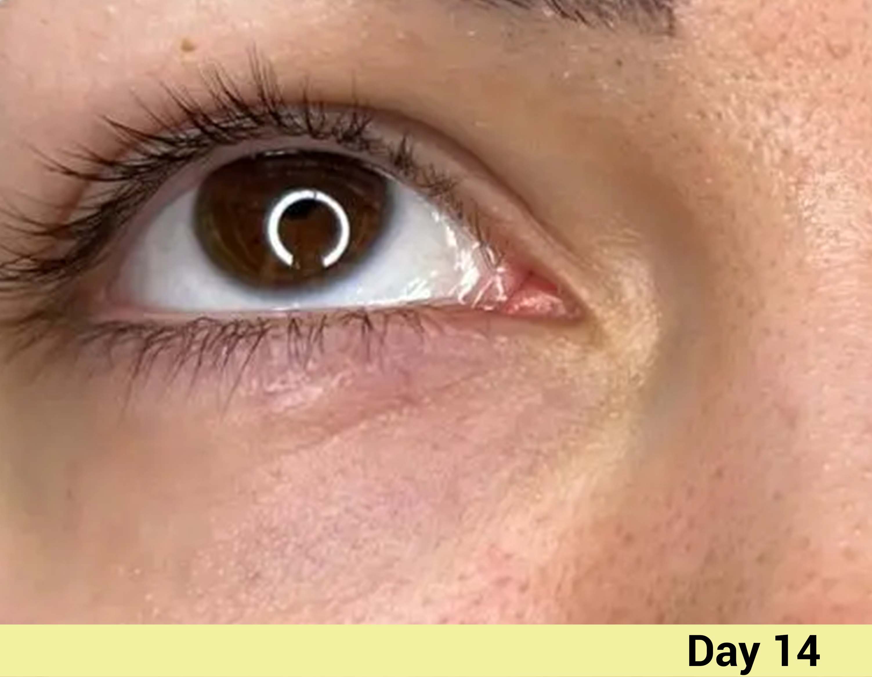 After image Real People. Real Results.