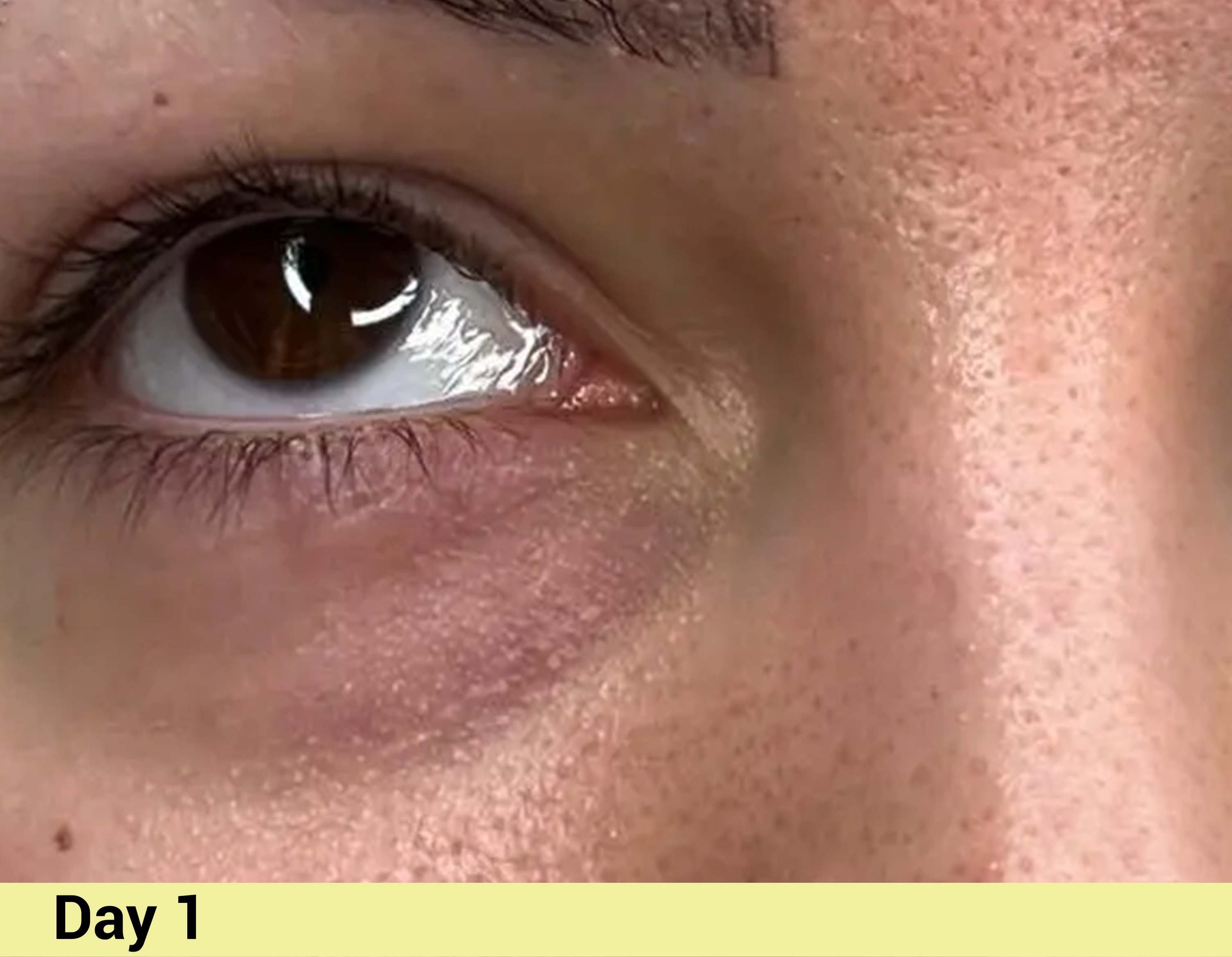 Before image Real People. Real Results.