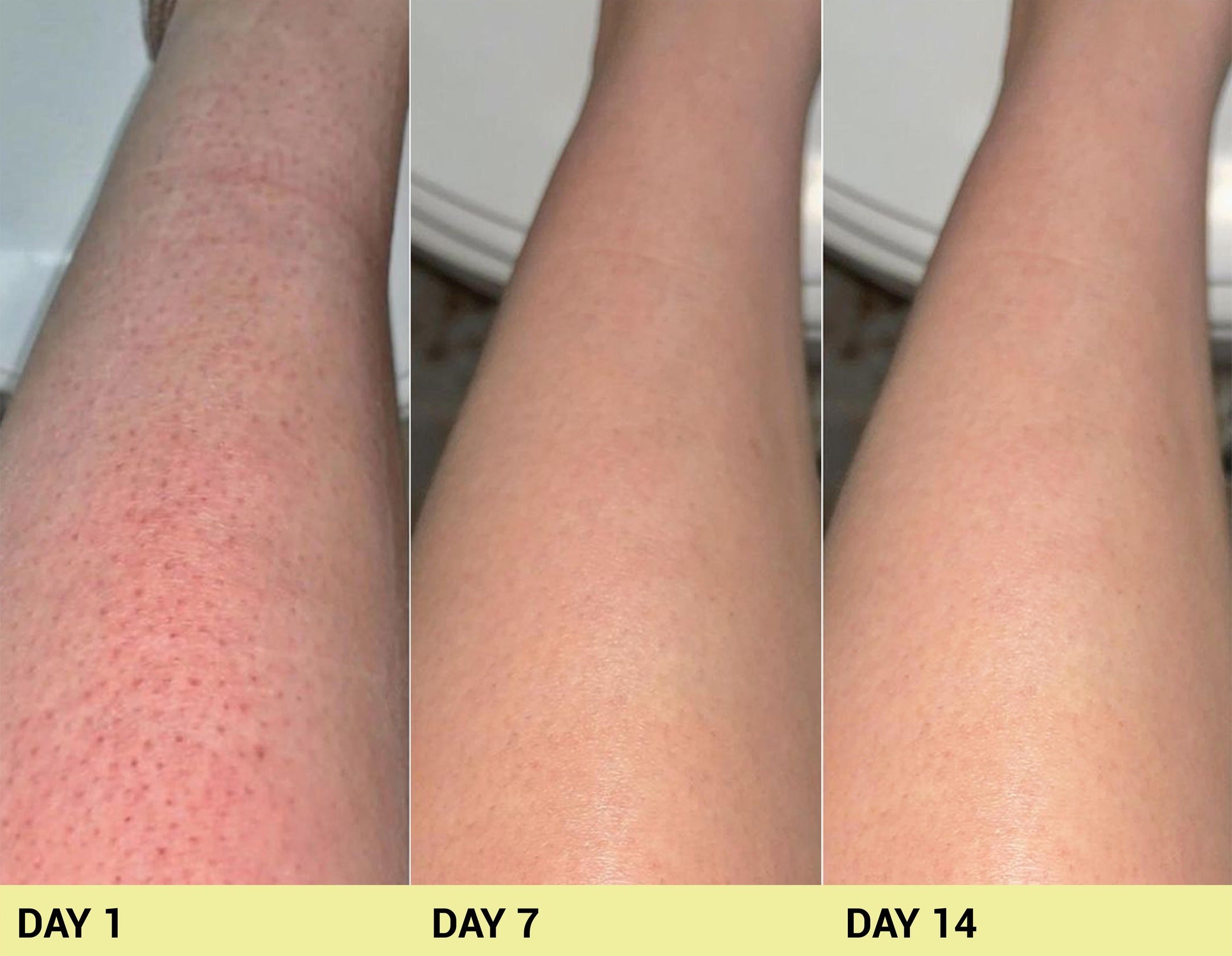 Before image Real People. Real Results.