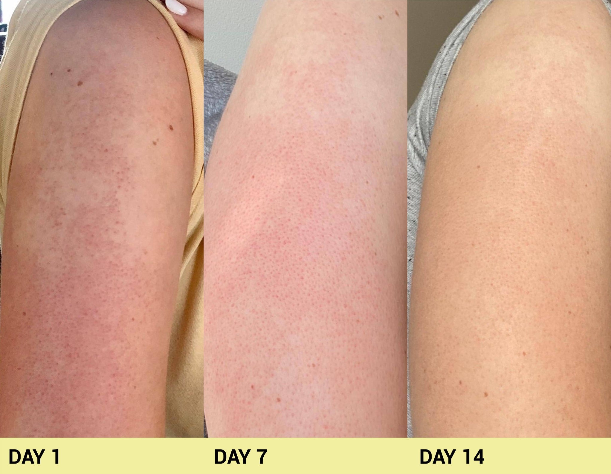 Before image Real People. Real Results.