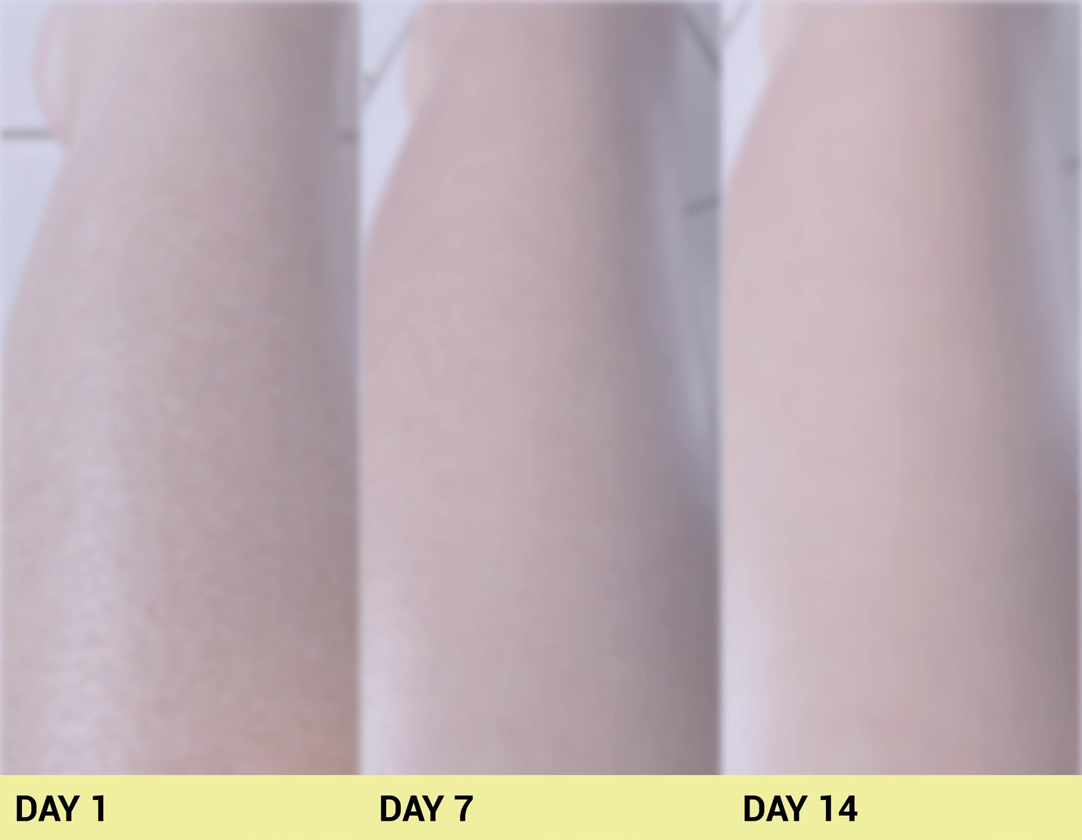 After image Real People. Real Results.