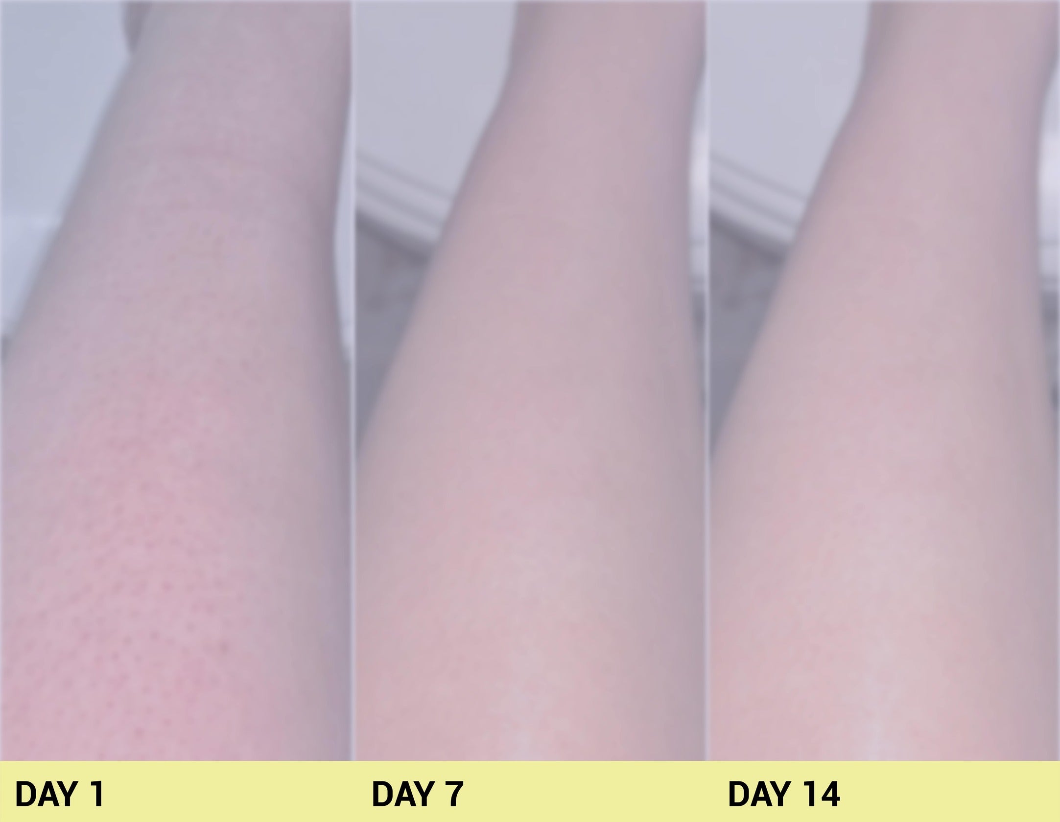 After image Real People. Real Results.