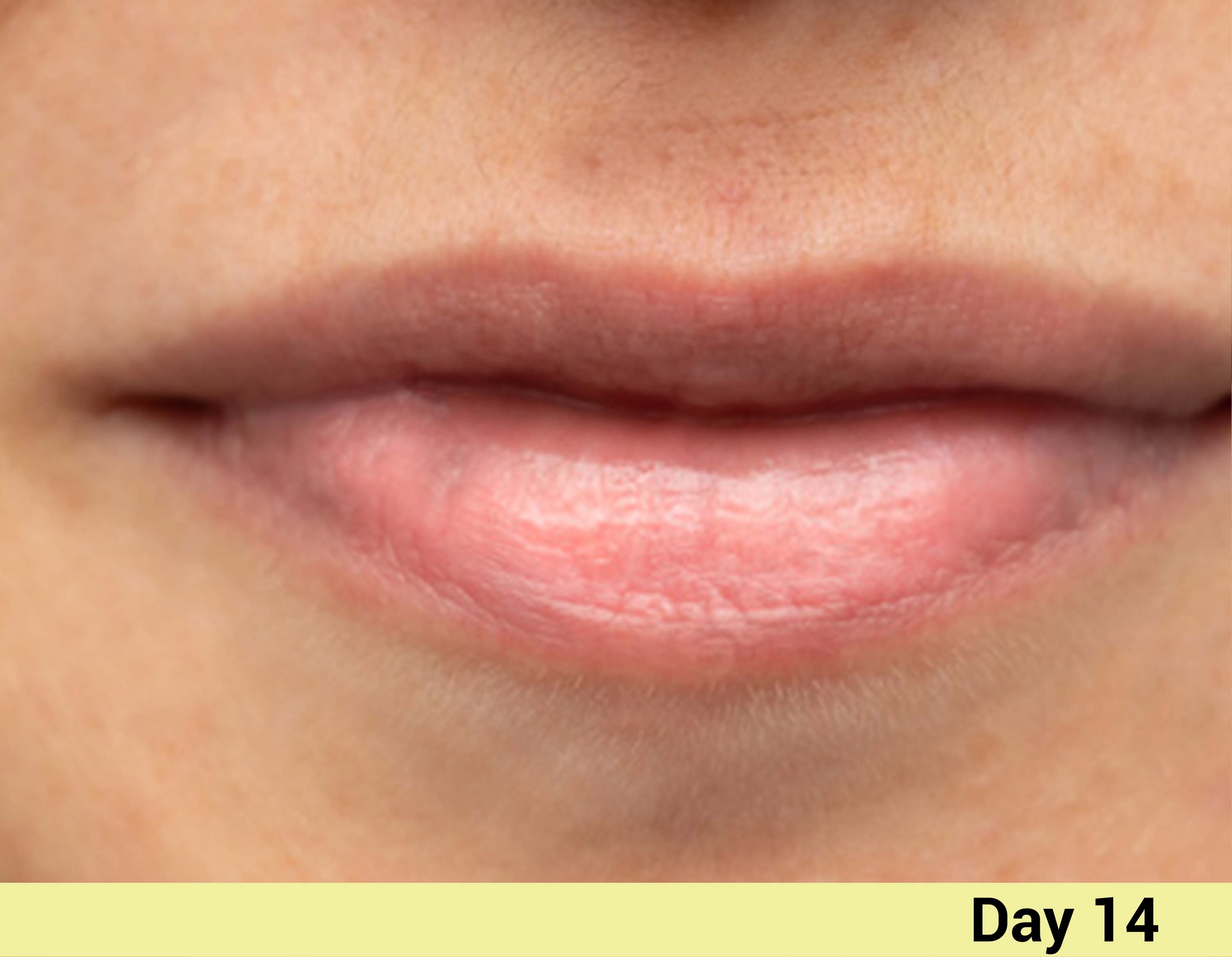 After image Real People. Real Results.