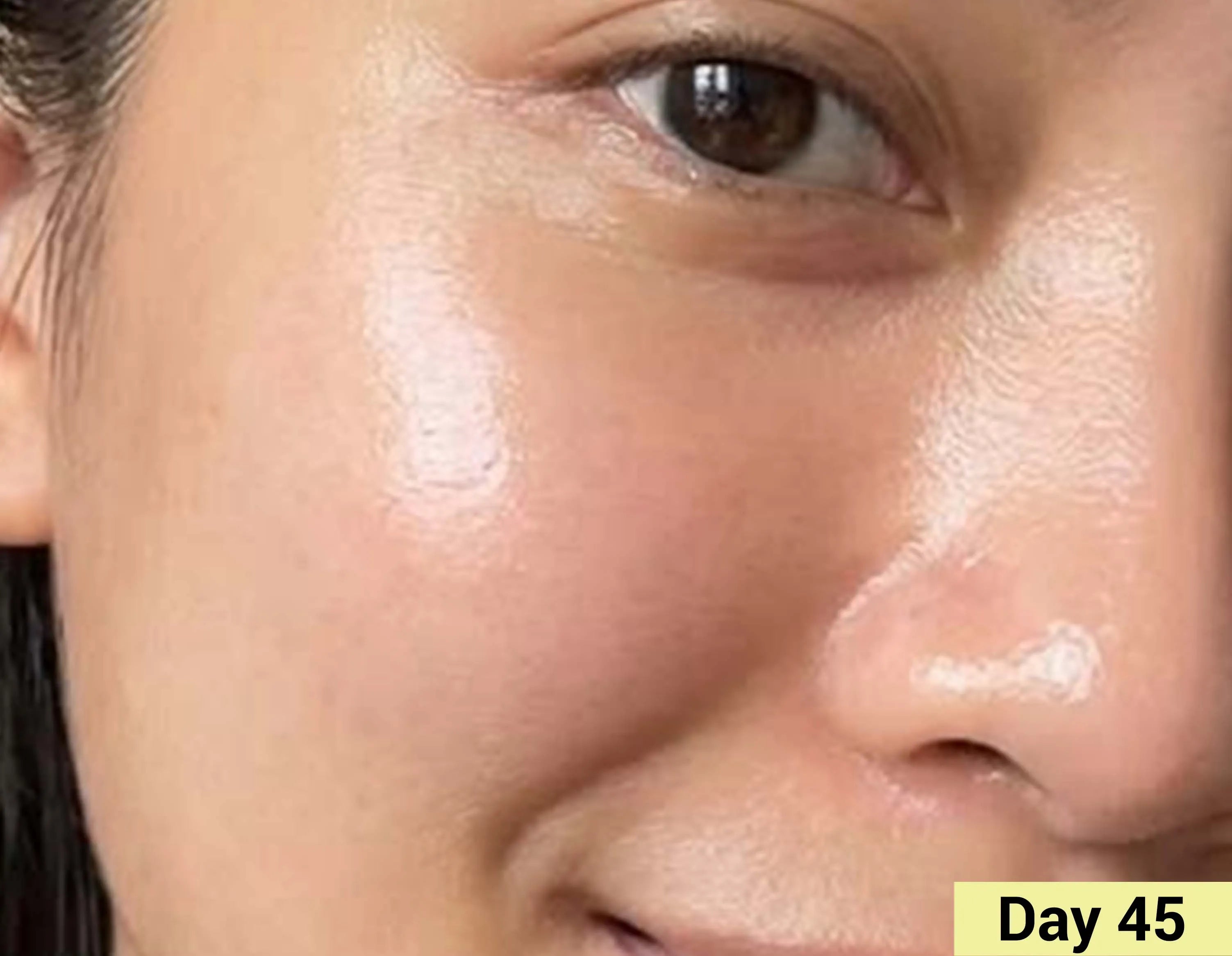 After image Real People. Real Results.