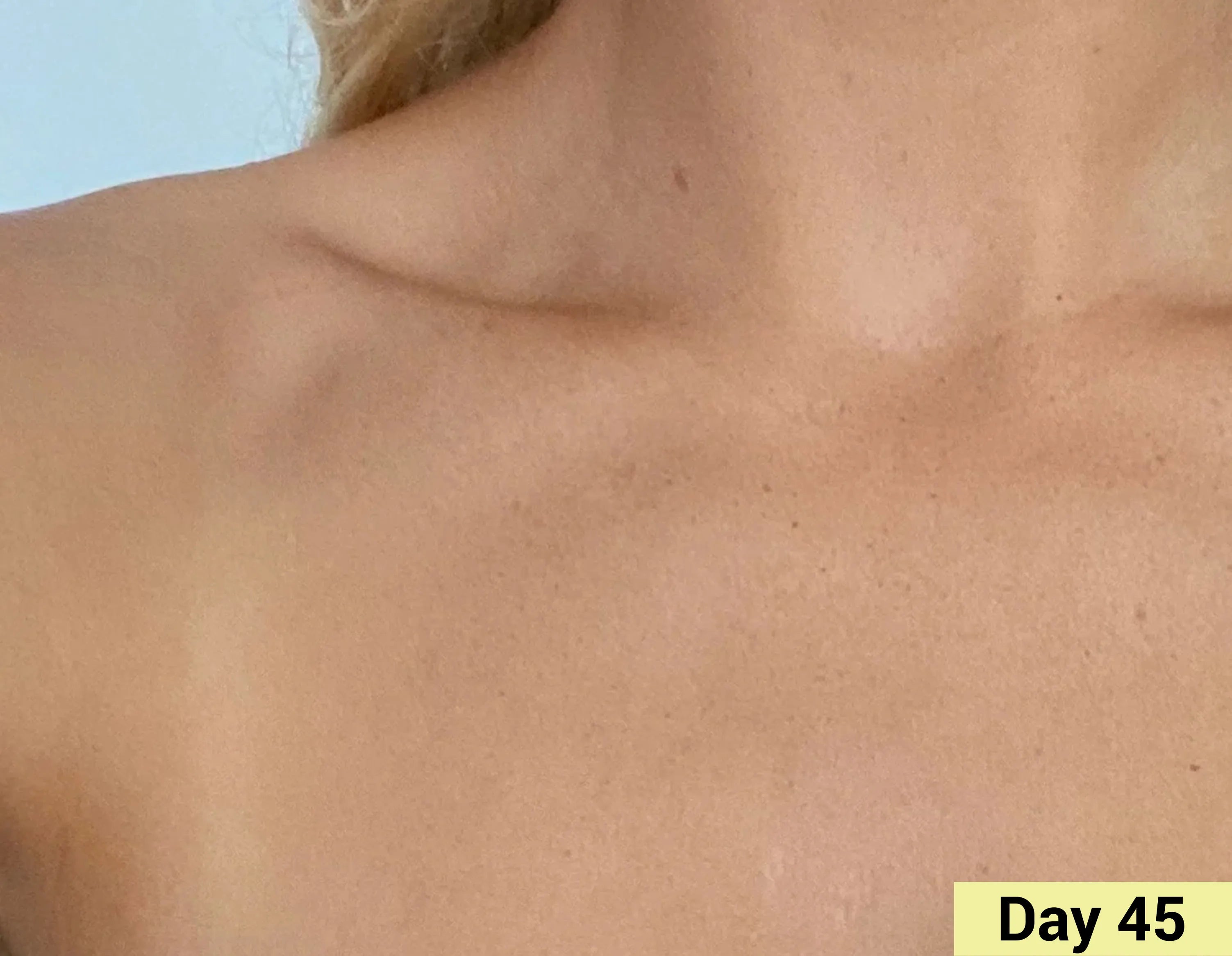 After image Real People. Real Results.