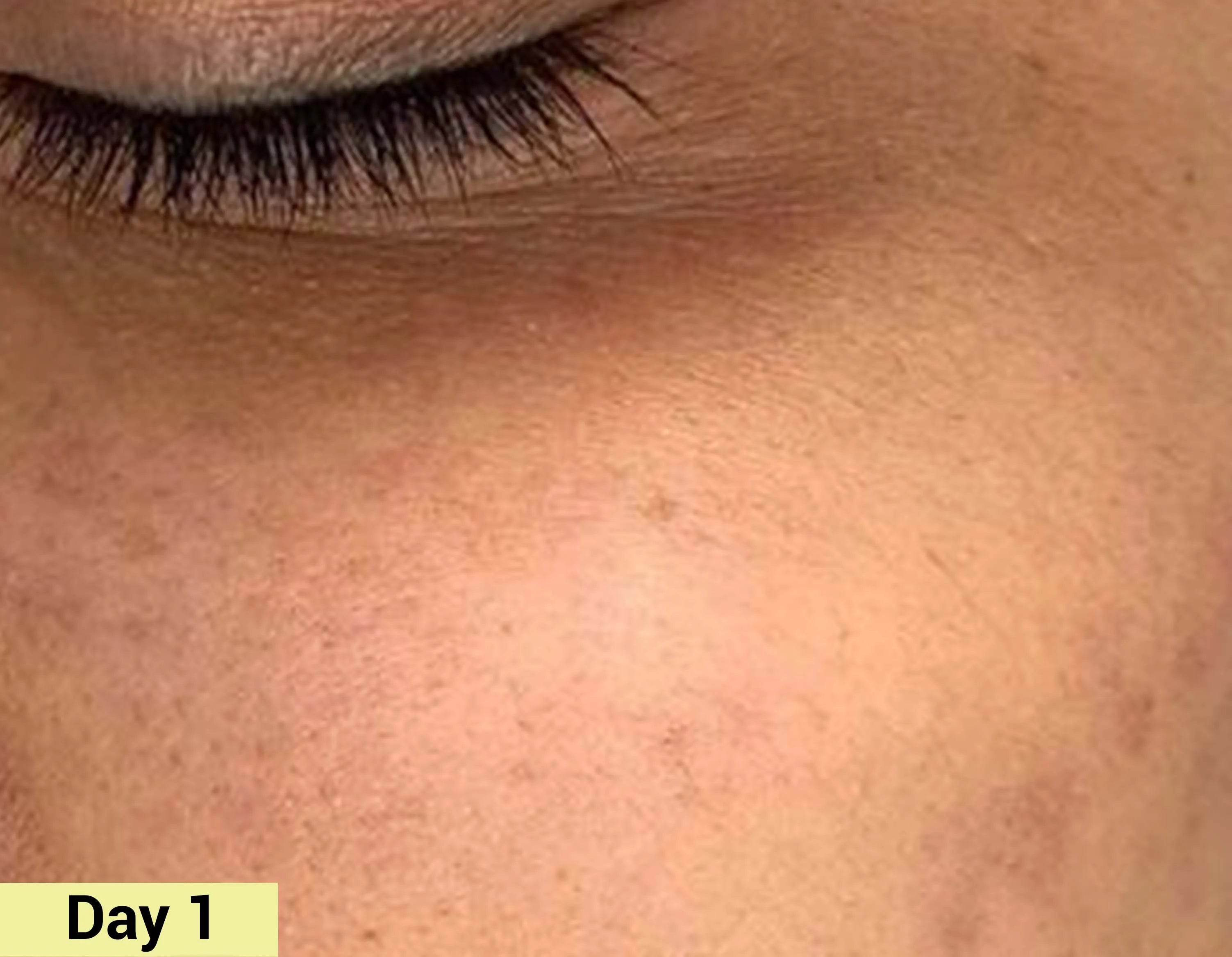 Before image Real People. Real Results.