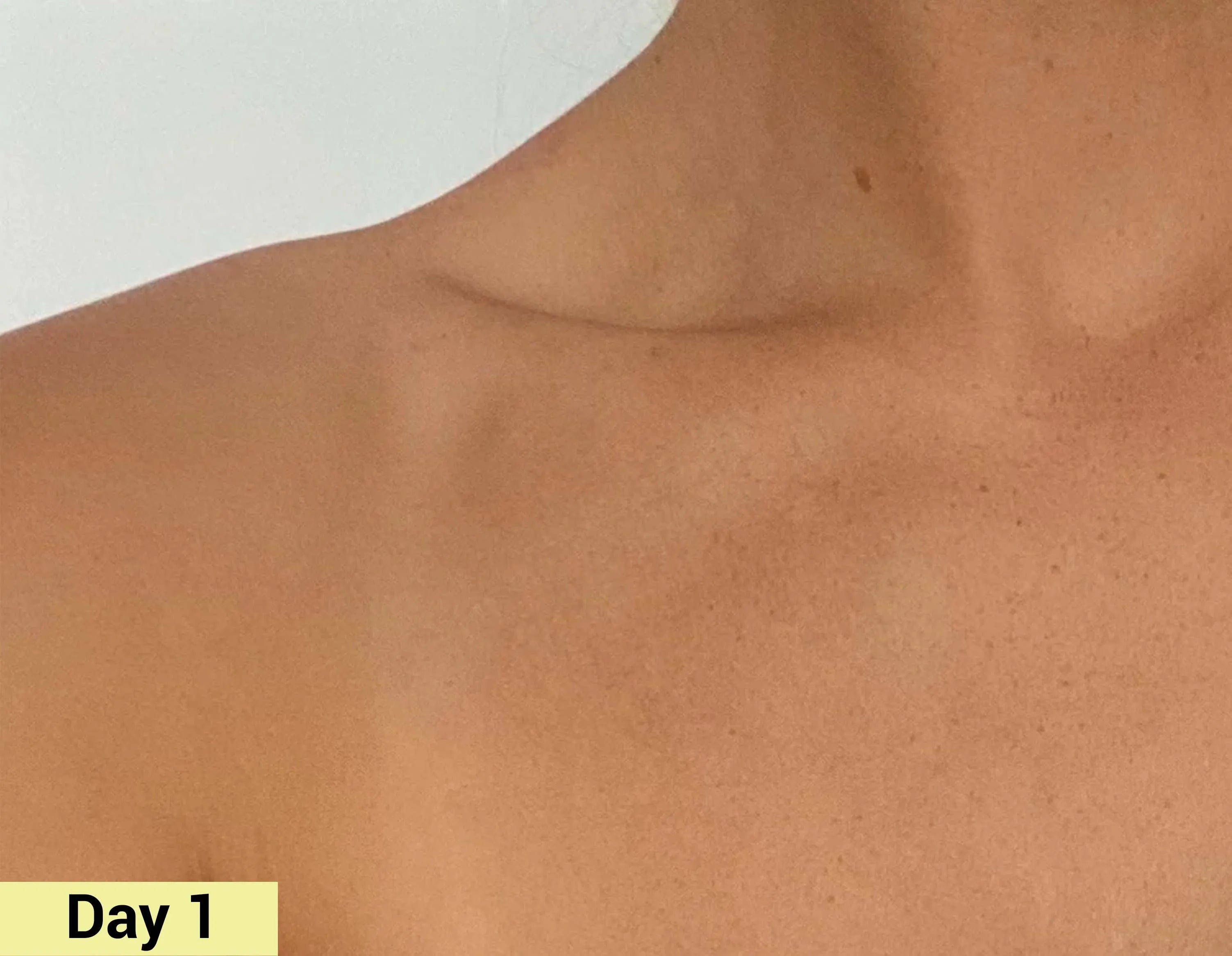 Before image Real People. Real Results.
