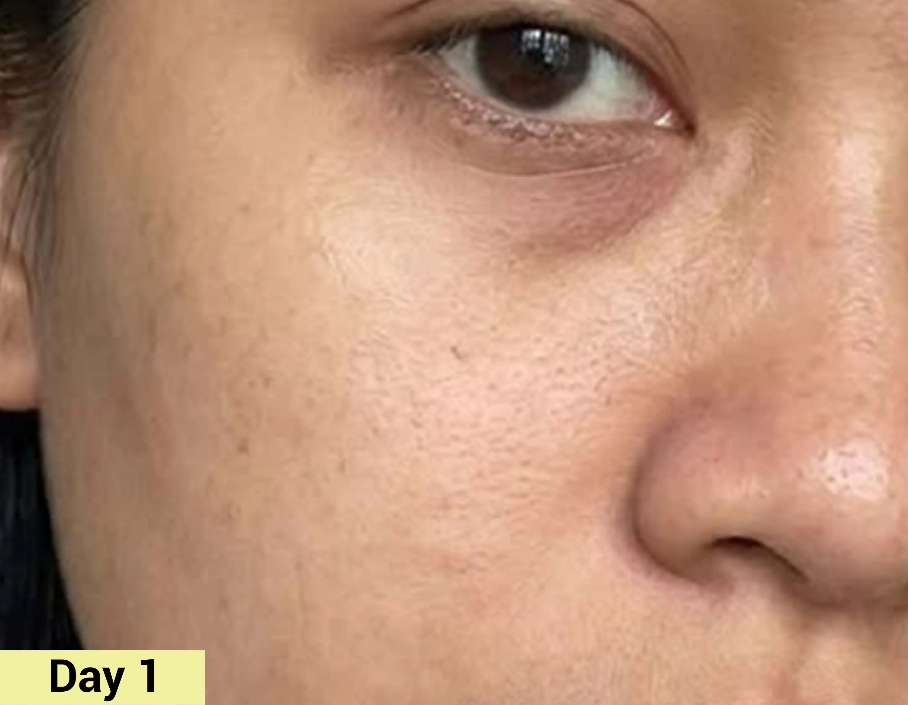 Before image Real People. Real Results.