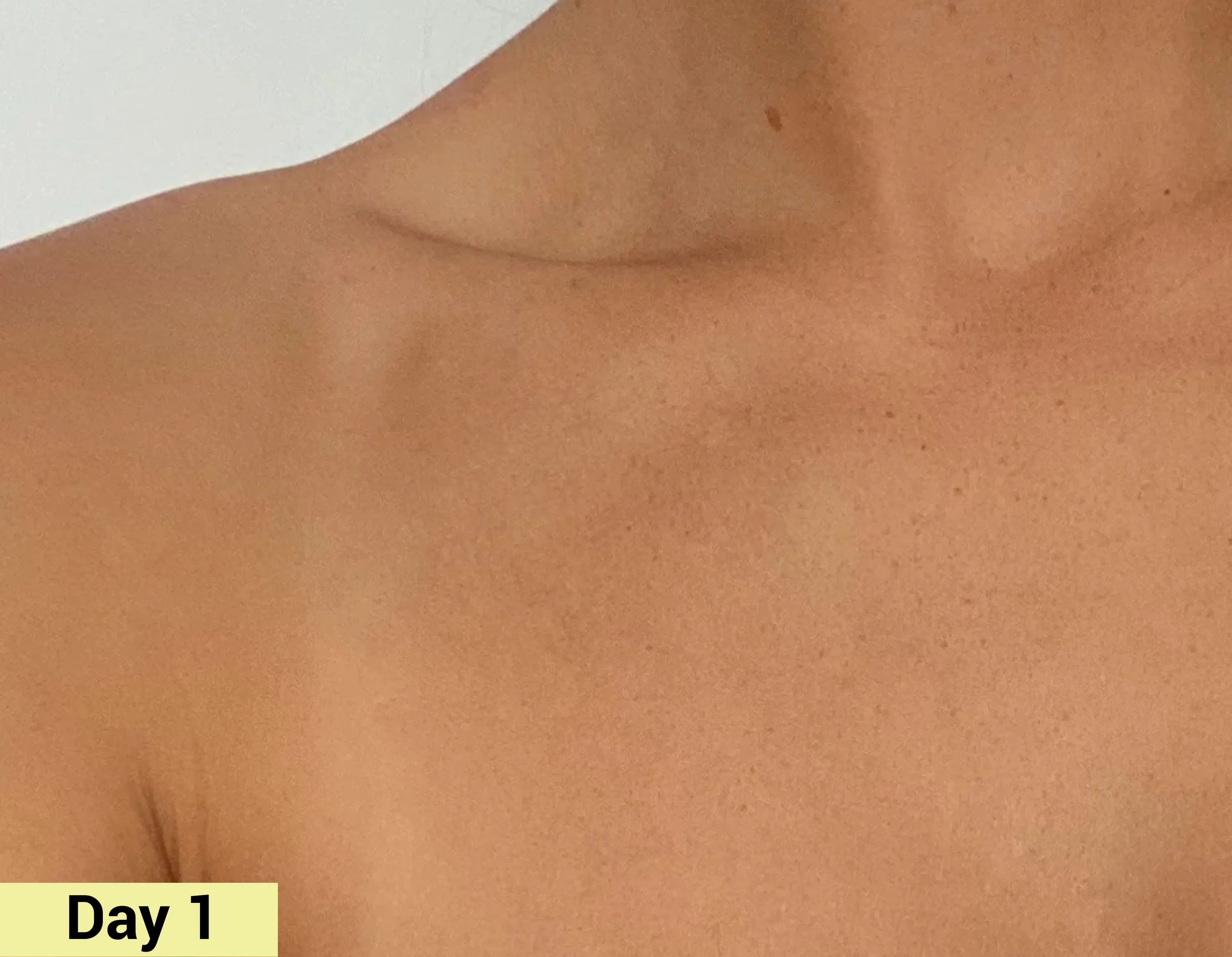 Before image Real People. Real Results.