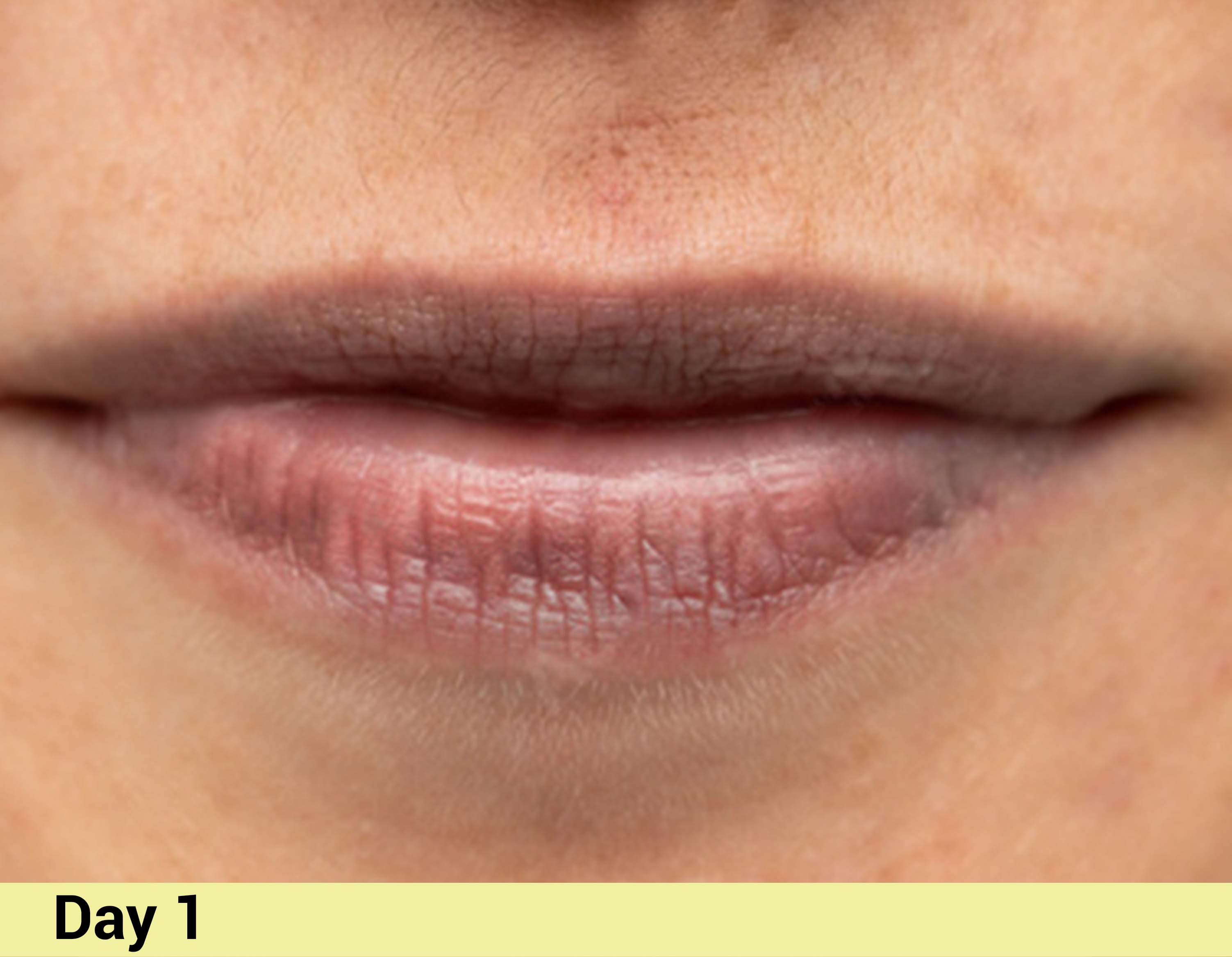 Before image Real People. Real Results.