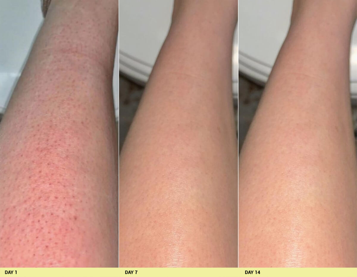 Before image Real People. Real Results.
