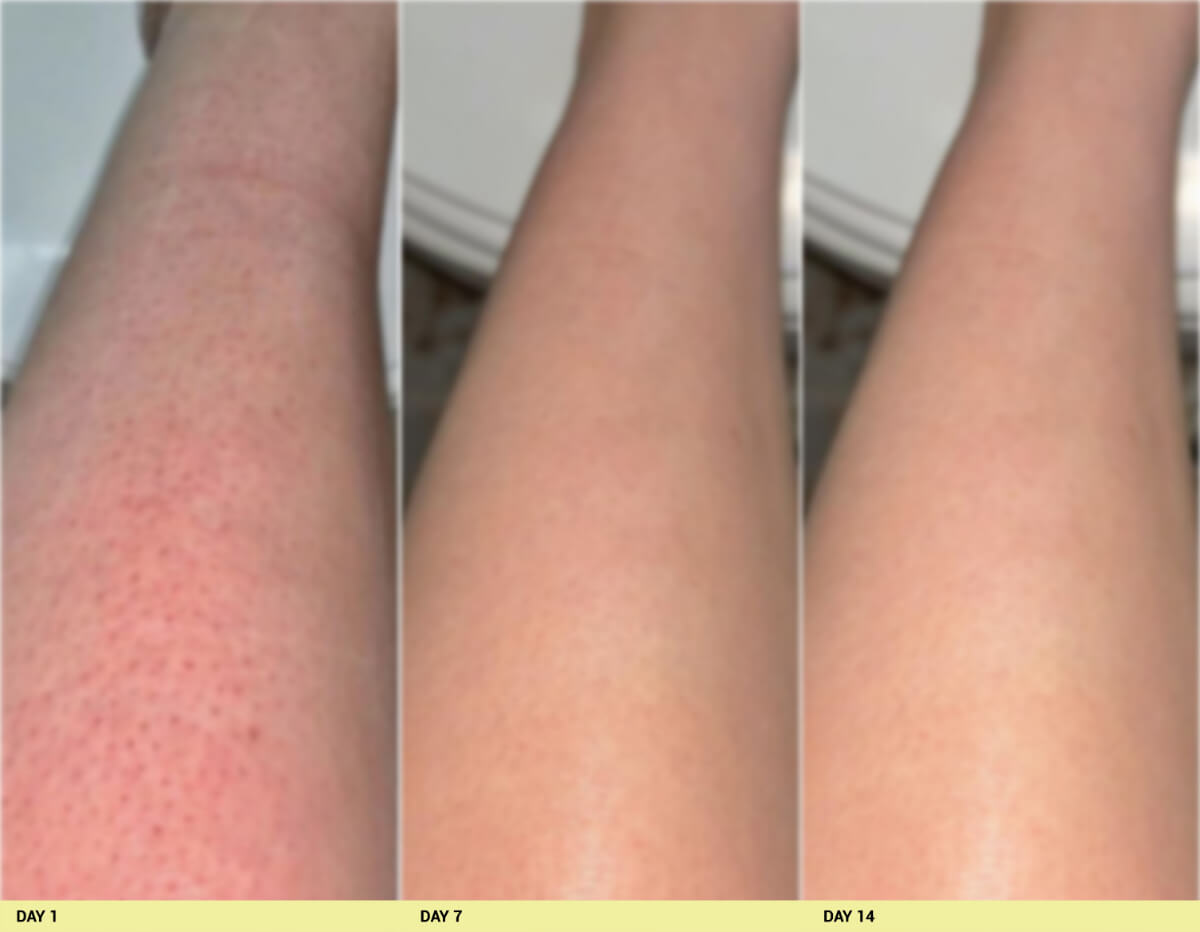 After image Real People. Real Results.