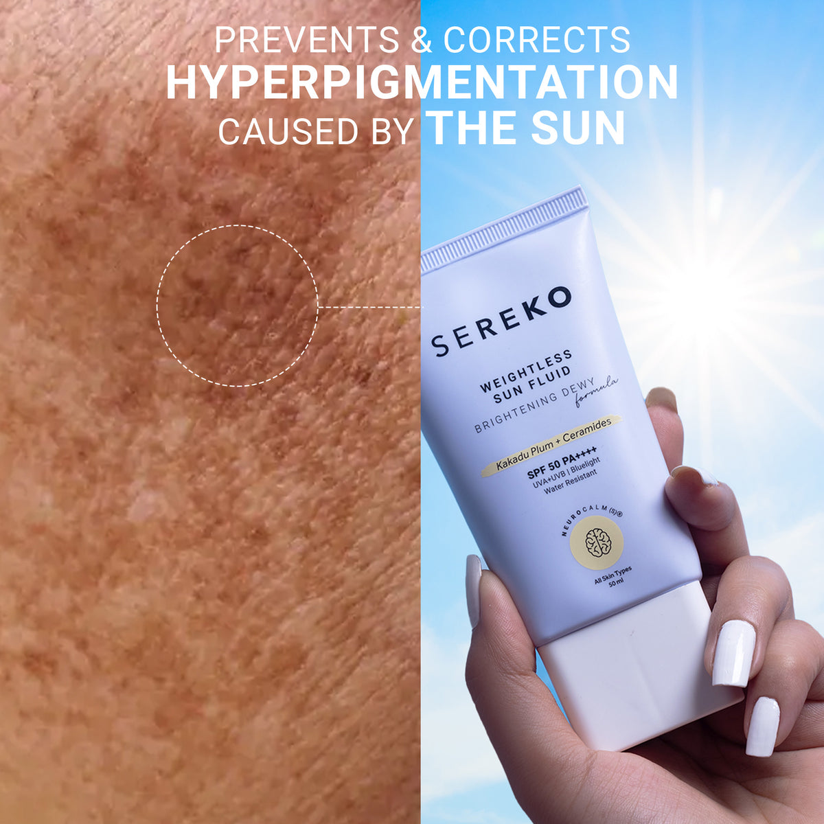Product media hyperpigmentation sunscreen