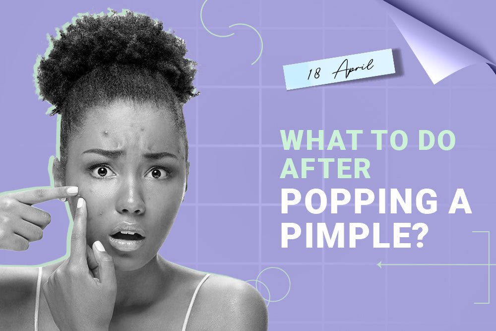 What To Do After Popping a Pimple?