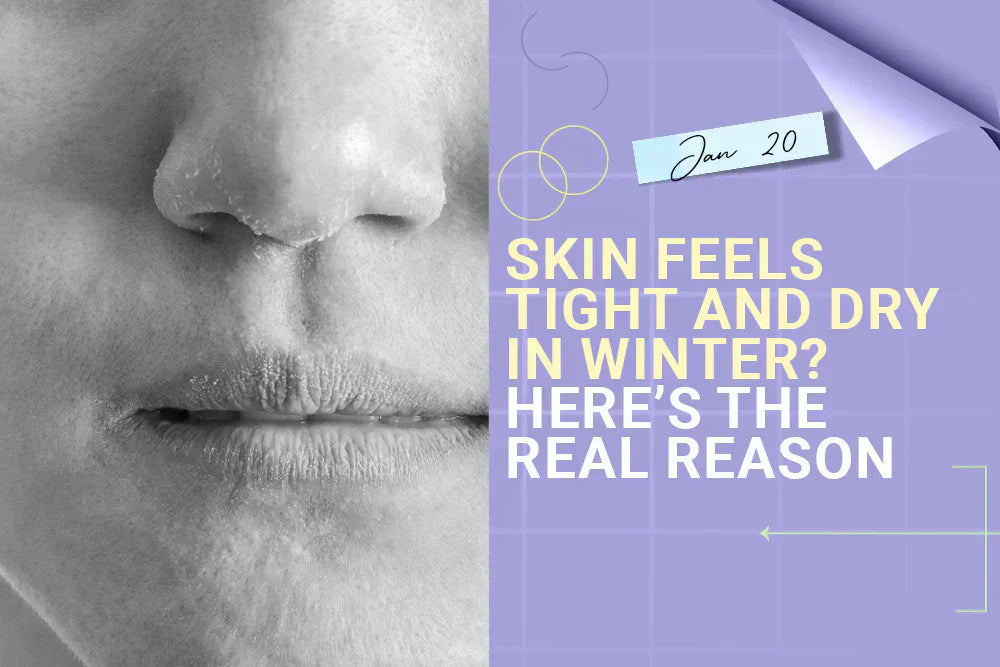 How to Get Rid of Tight, Dry Skin in Winter?
