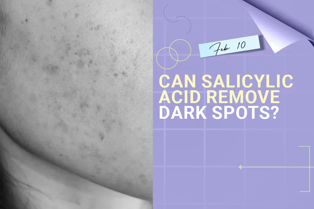 Can Salicylic Acid Remove Dark Spots?