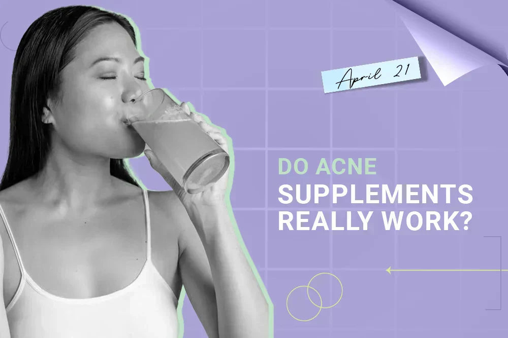 Do Acne Supplements Really Work?