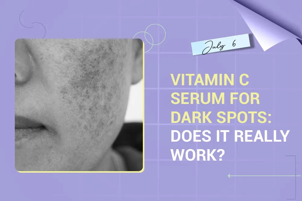 Vitamin C Serum for Dark Spots: Does It Really Work?