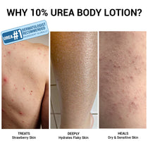 Hydra-Repair 10% Urea and Avocado Oil Body Lotion
