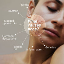 Anti-Acne Advanced Detox Kit